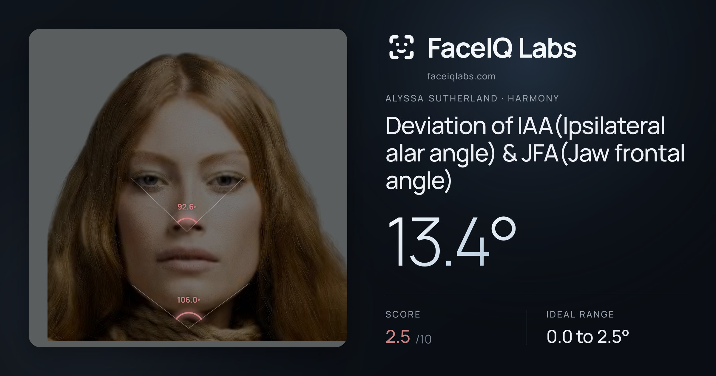 Alyssa Sutherland Deviation of IAA(Ipsilateral alar angle) & JFA(Jaw frontal angle): 13.4°, drawn on the photo