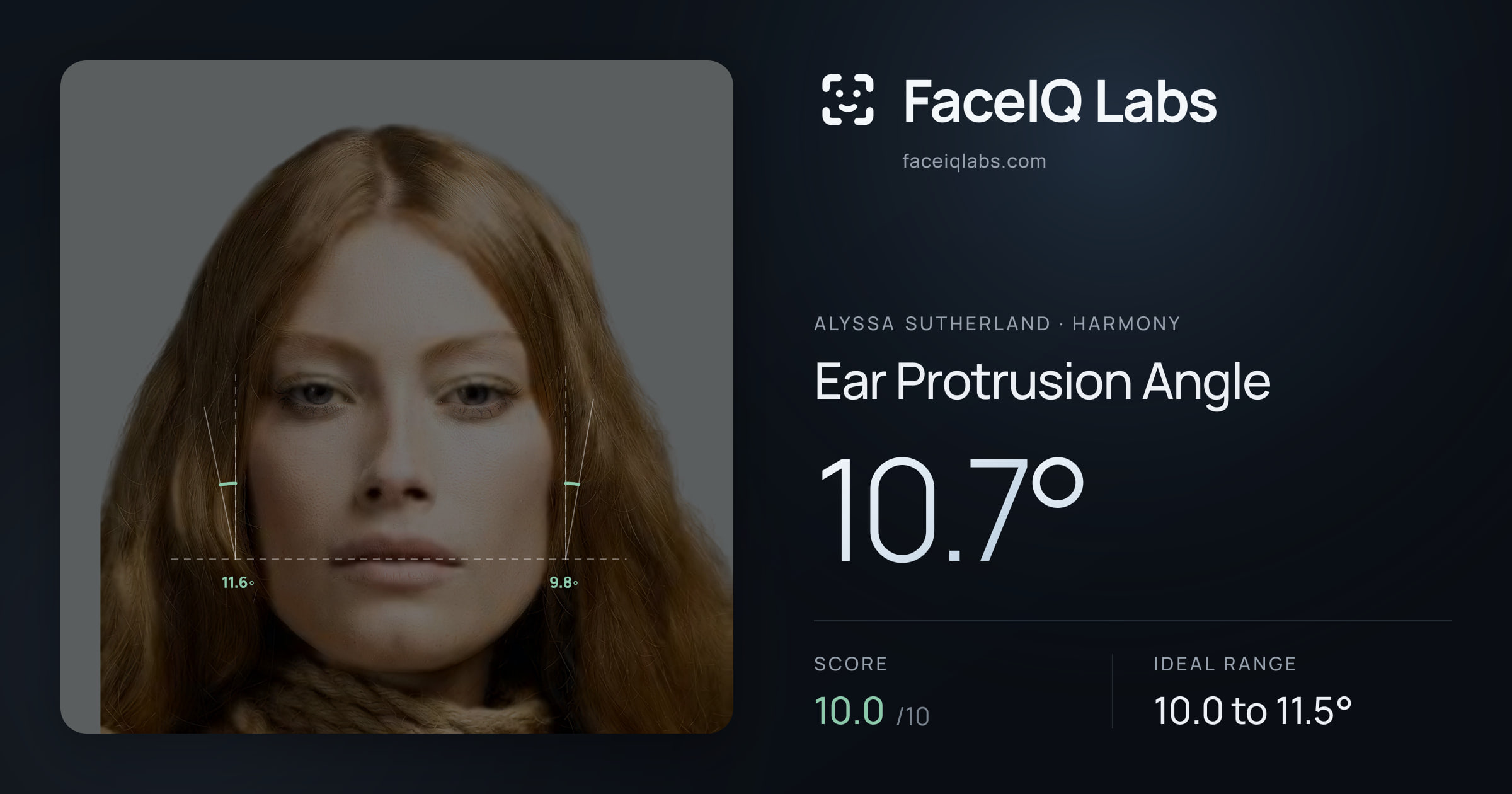 Alyssa Sutherland Ear Protrusion Angle: 10.7°, drawn on the photo