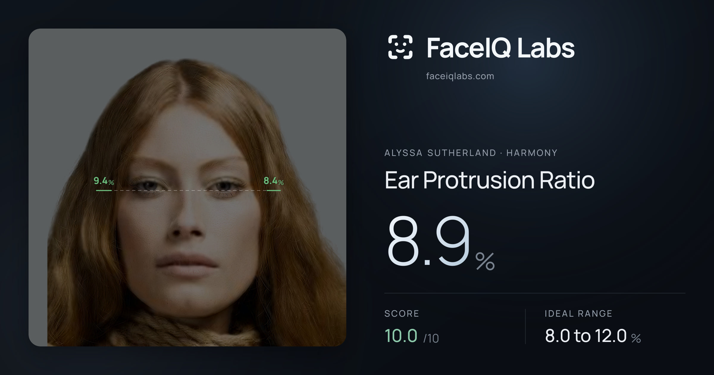 Alyssa Sutherland Ear Protrusion Ratio: 8.9%, drawn on the photo