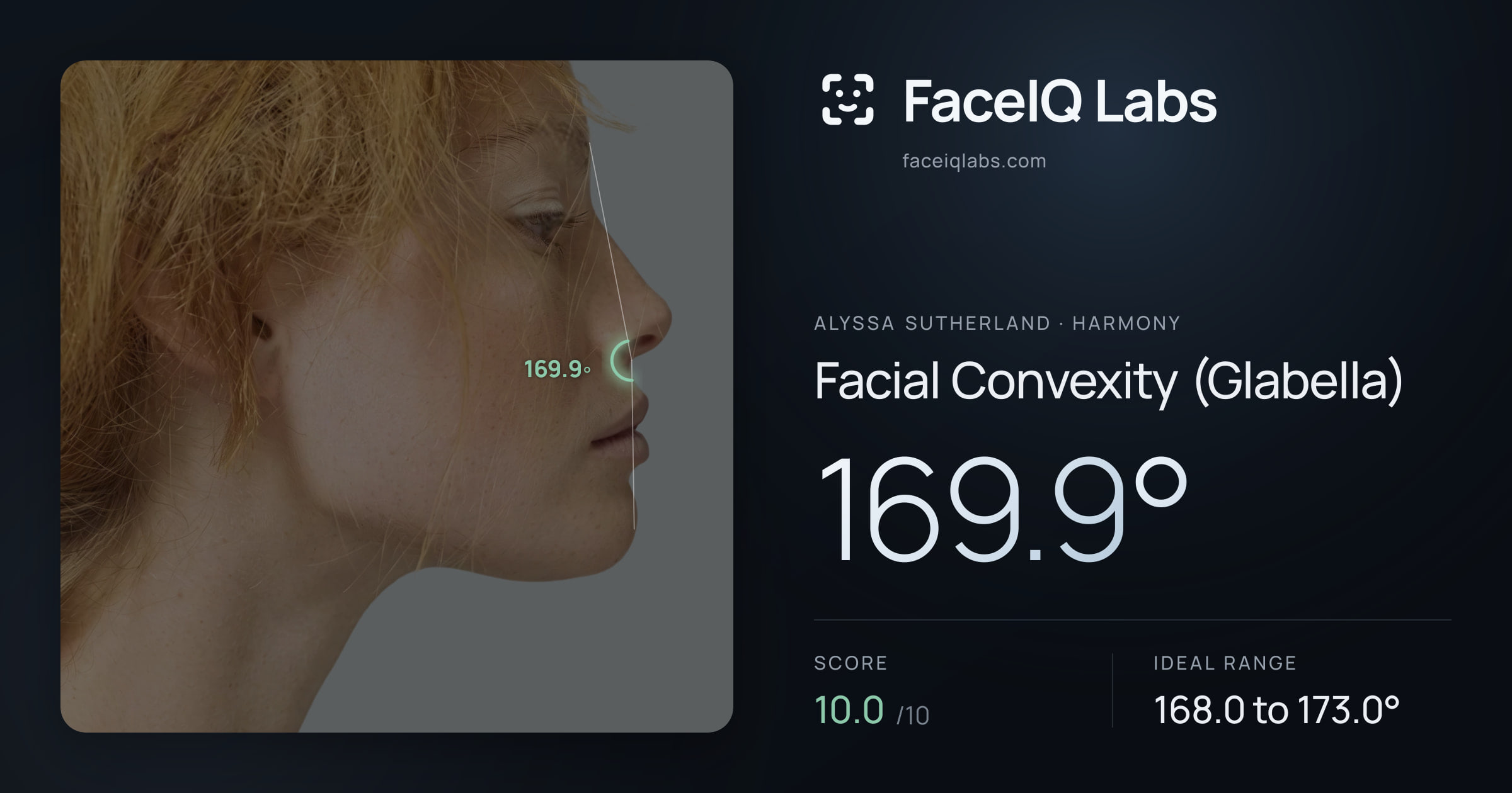 Alyssa Sutherland Facial Convexity (Glabella): 169.9°, drawn on the photo