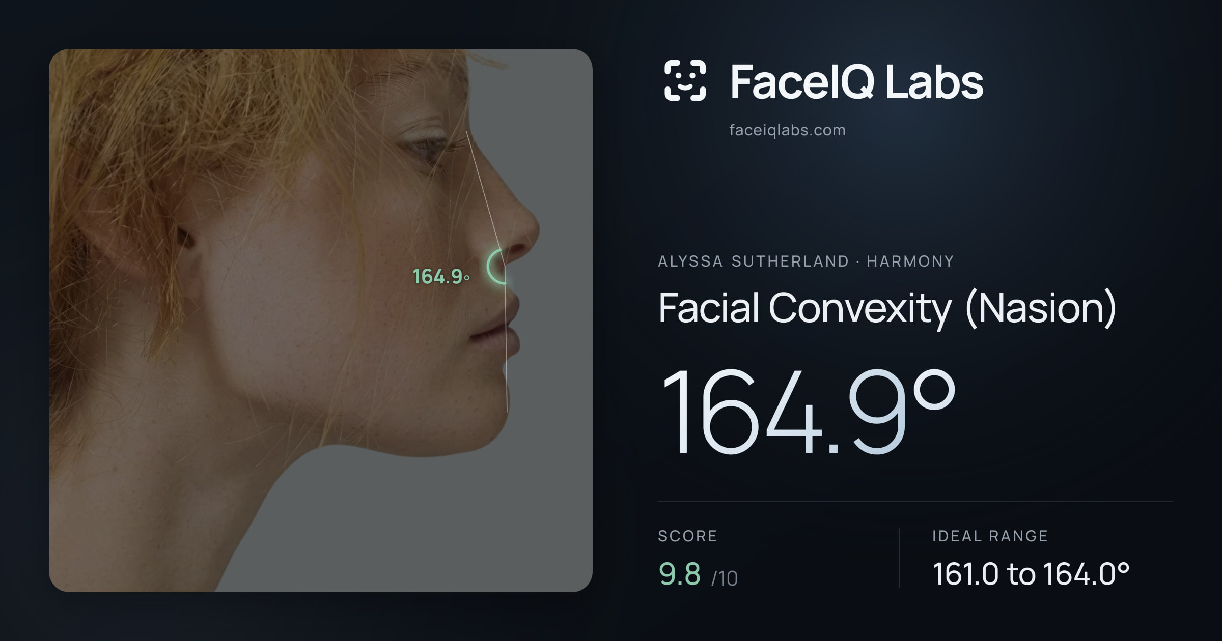Alyssa Sutherland Facial Convexity (Nasion): 164.9°, drawn on the photo
