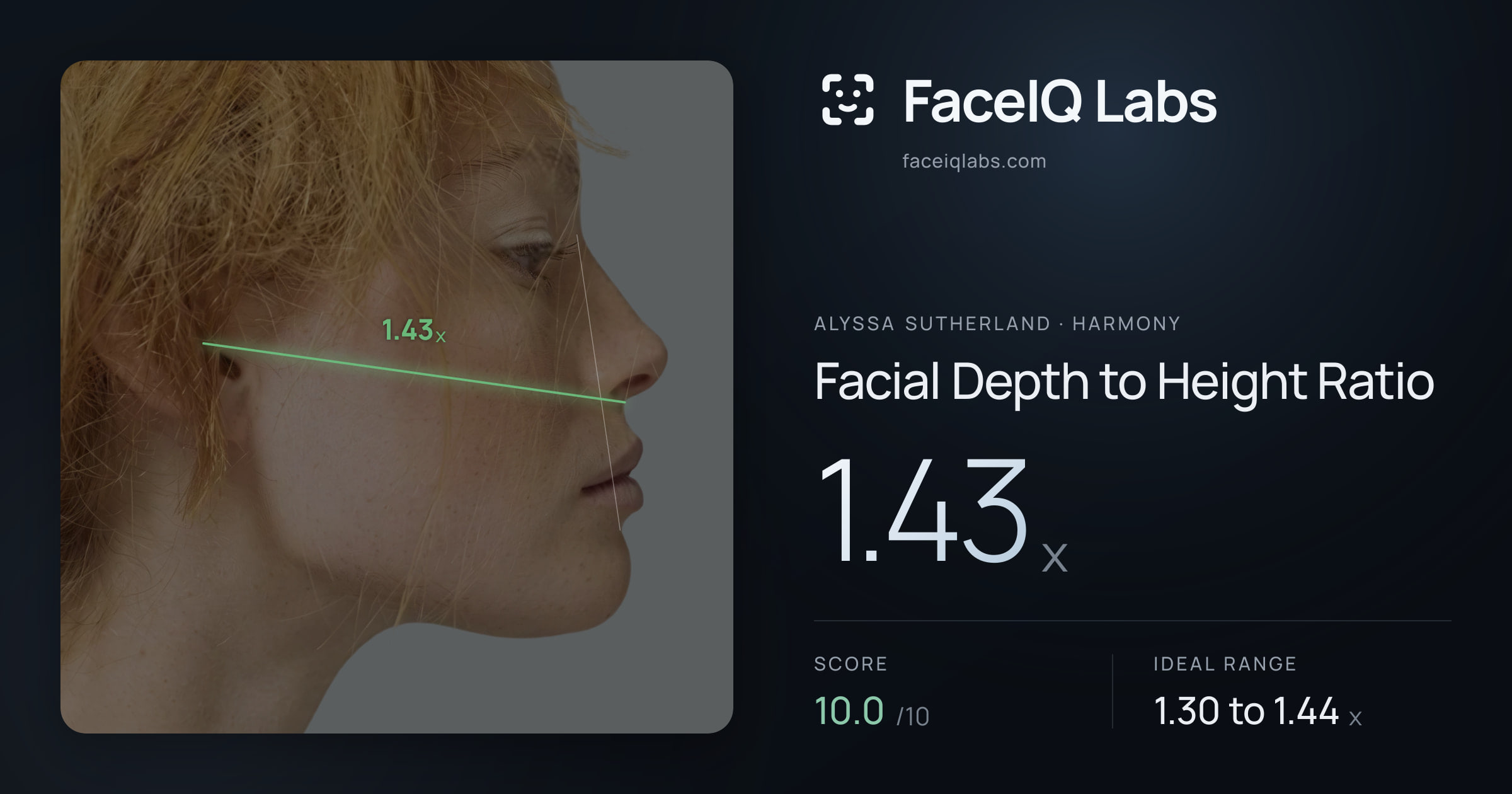 Alyssa Sutherland Facial Depth to Height Ratio: 1.43x, drawn on the photo