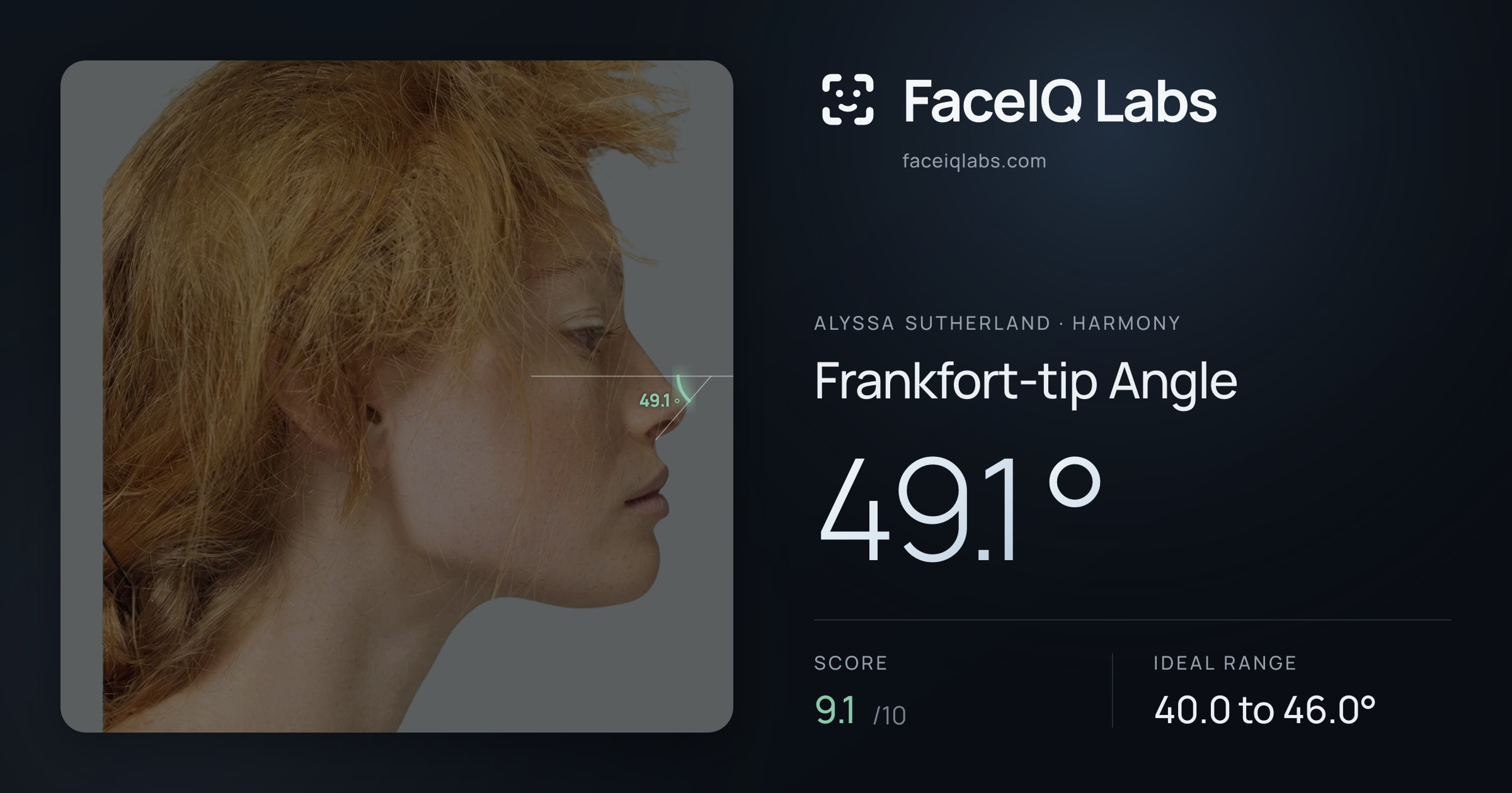 Alyssa Sutherland Frankfort-tip Angle: 49.1°, drawn on the photo