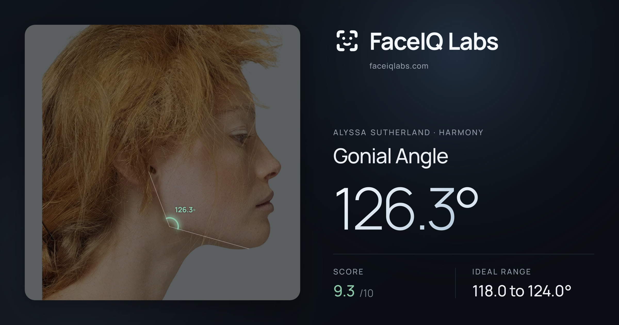 Alyssa Sutherland Gonial Angle: 126.3°, drawn on the photo
