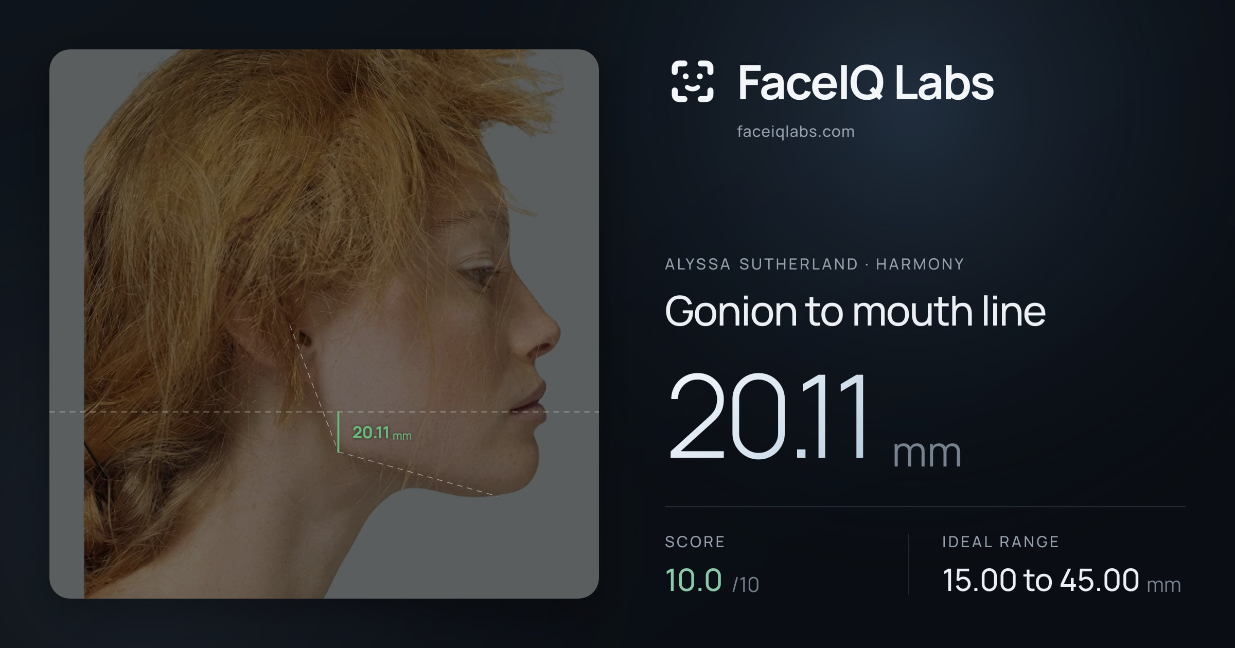 Alyssa Sutherland Gonion to mouth line: 20.11mm, drawn on the photo