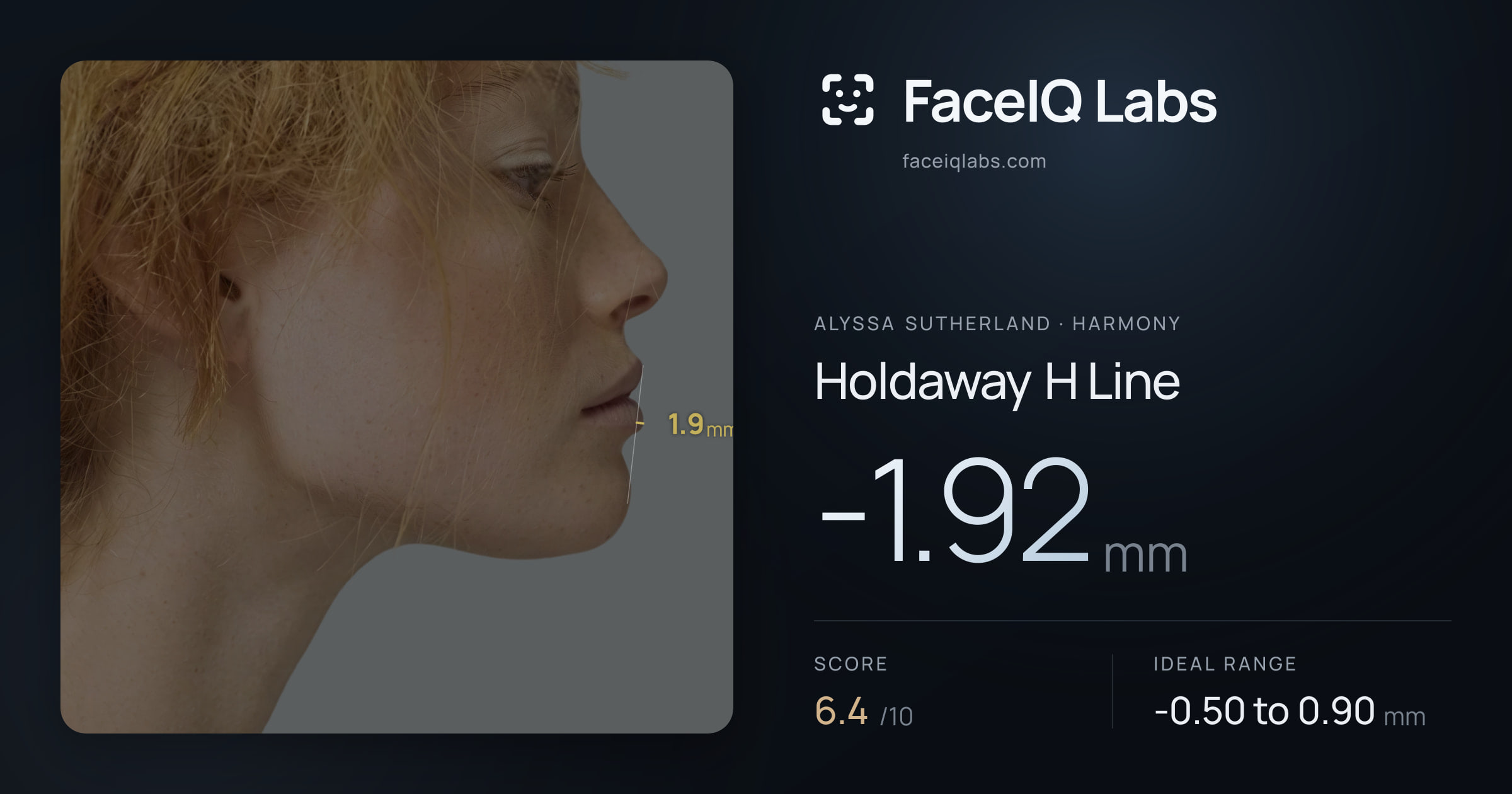 Alyssa Sutherland Holdaway H Line: -1.92mm, drawn on the photo