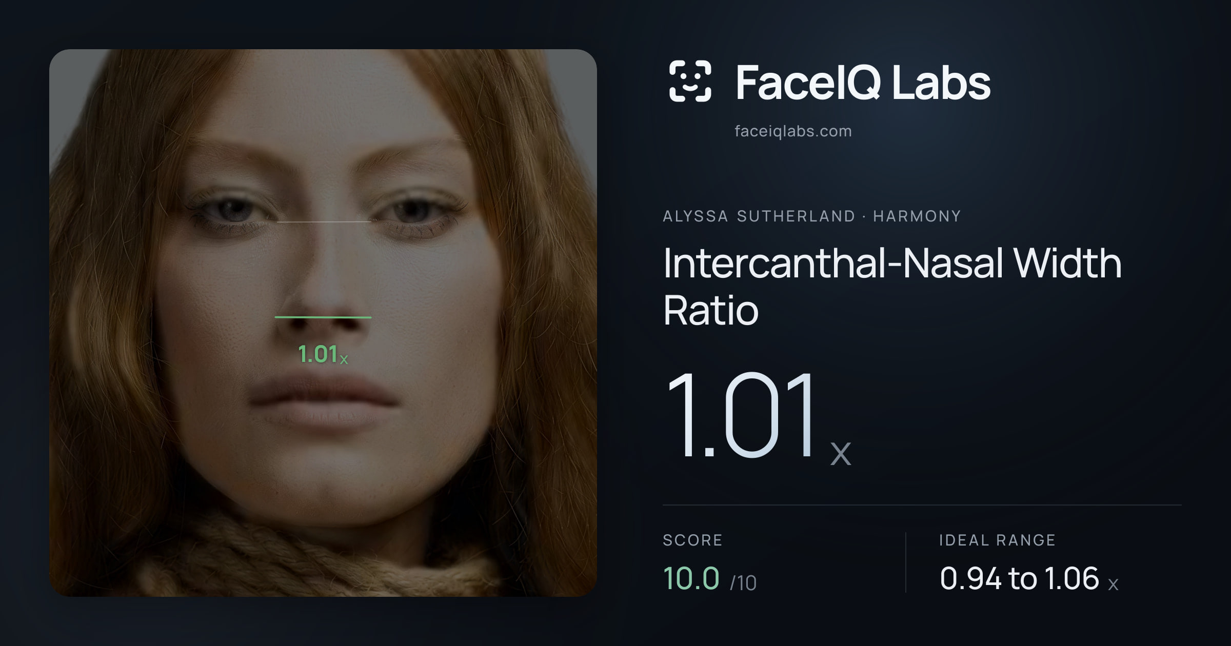 Alyssa Sutherland Intercanthal-Nasal Width Ratio: 1.01x, drawn on the photo