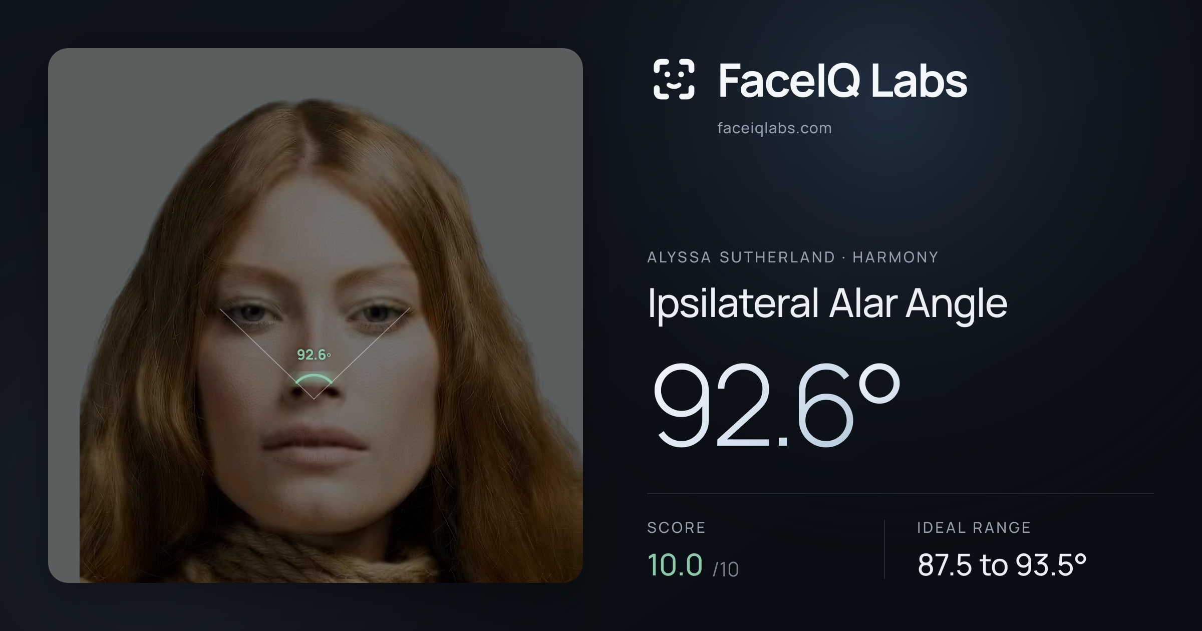 Alyssa Sutherland Ipsilateral Alar Angle: 92.6°, drawn on the photo
