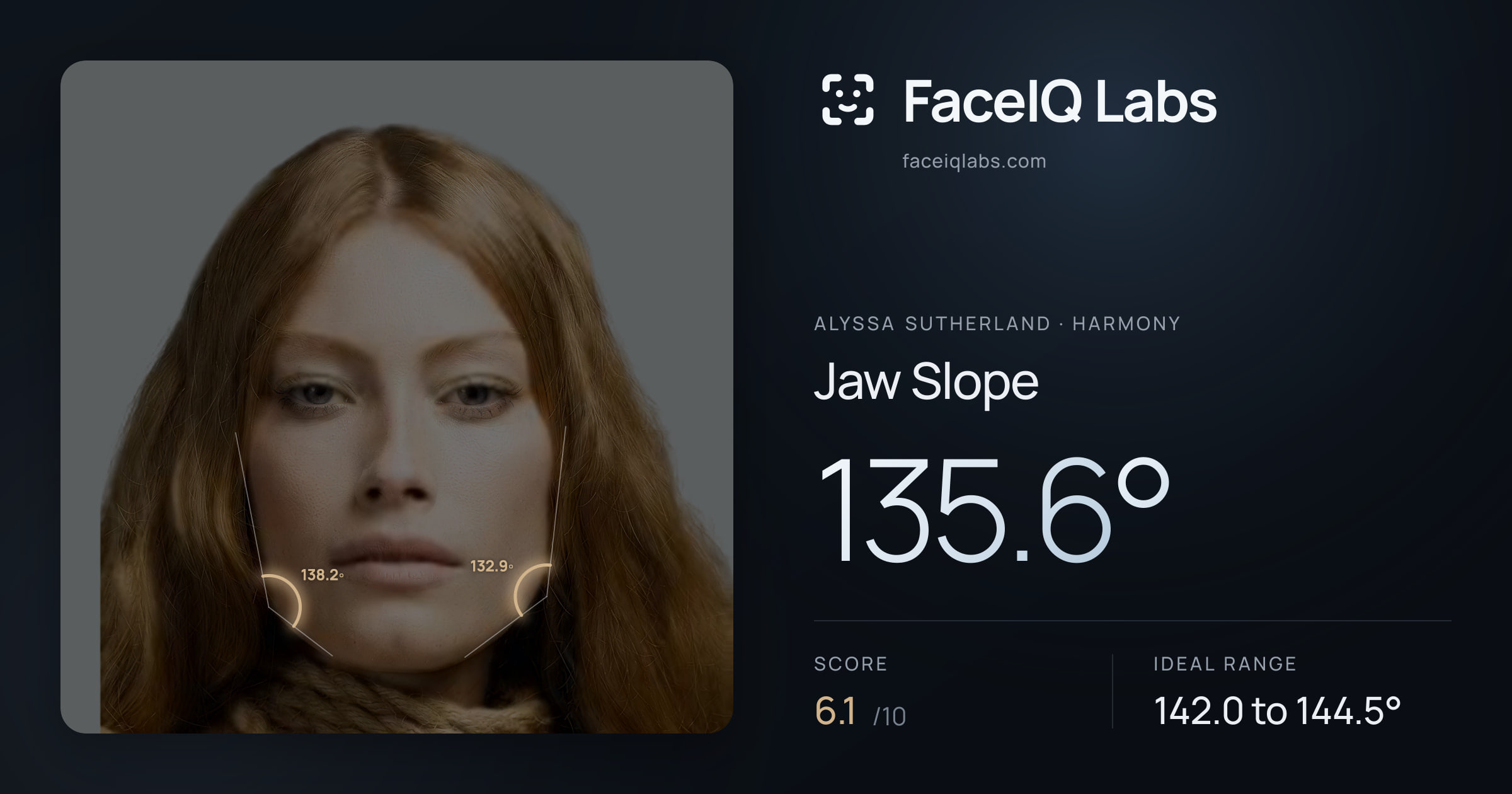 Alyssa Sutherland Jaw Slope: 135.6°, drawn on the photo