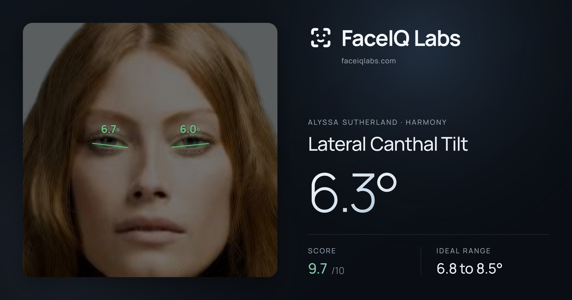 Alyssa Sutherland Lateral Canthal Tilt: 6.3°, drawn on the photo