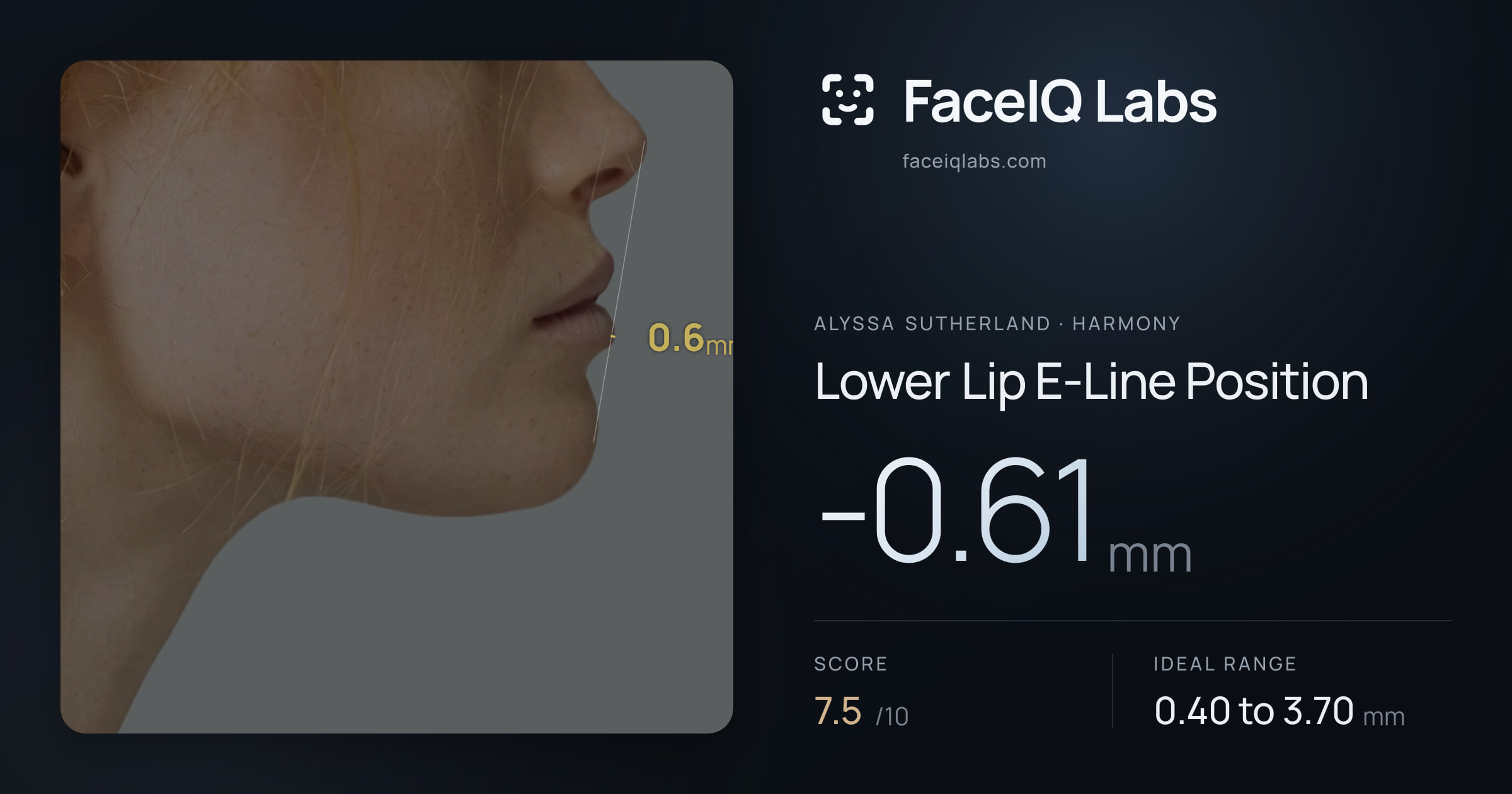 Alyssa Sutherland Lower Lip E-Line Position: -0.61mm, drawn on the photo