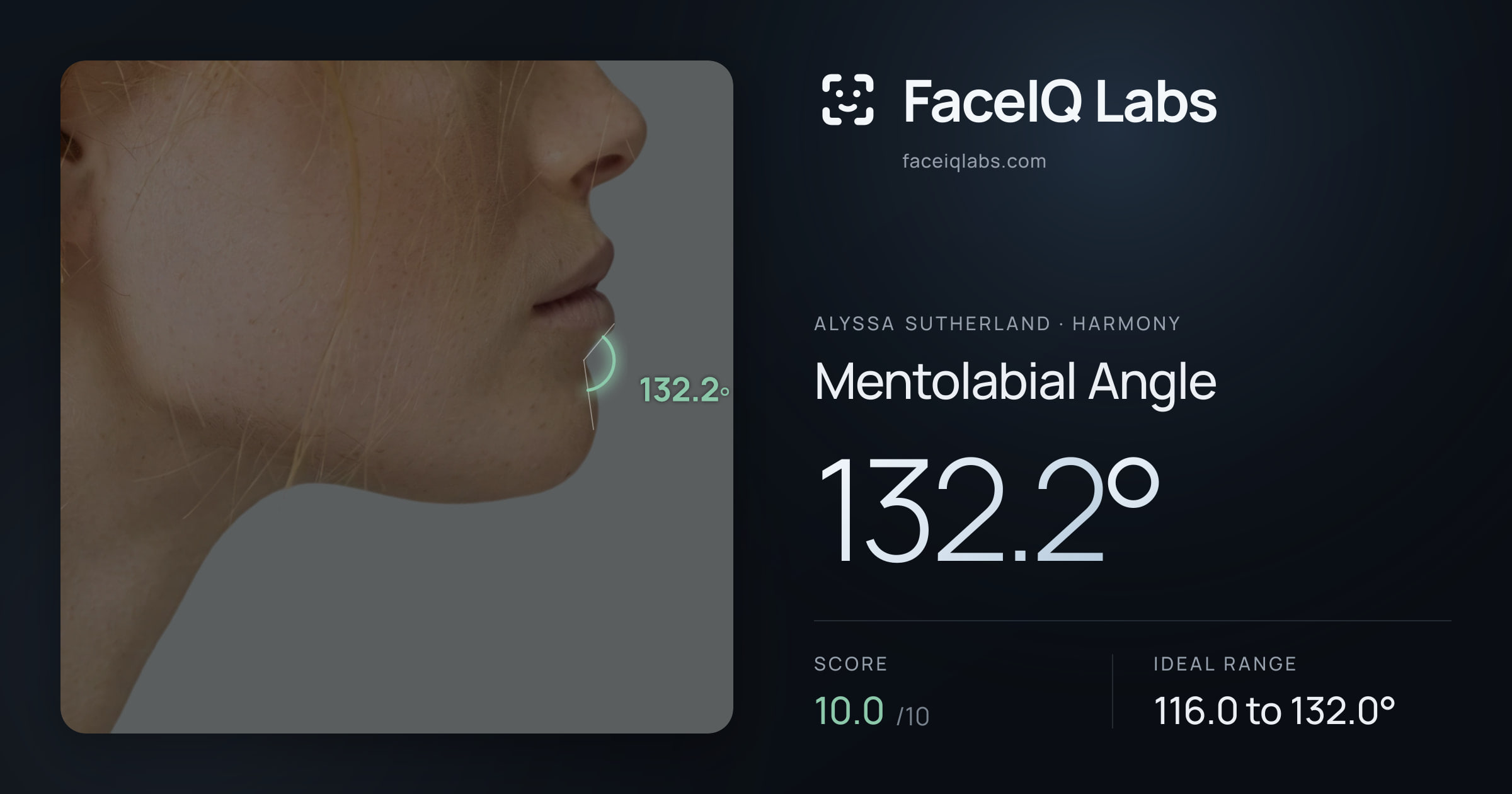 Alyssa Sutherland Mentolabial Angle: 132.2°, drawn on the photo