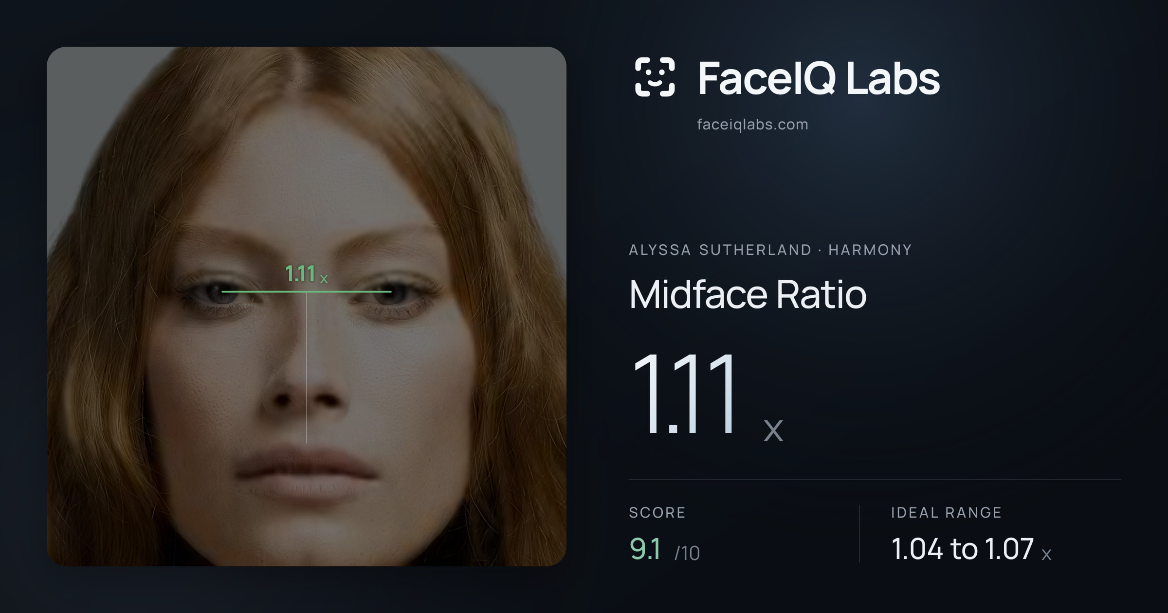 Alyssa Sutherland Midface Ratio: 1.11x, drawn on the photo
