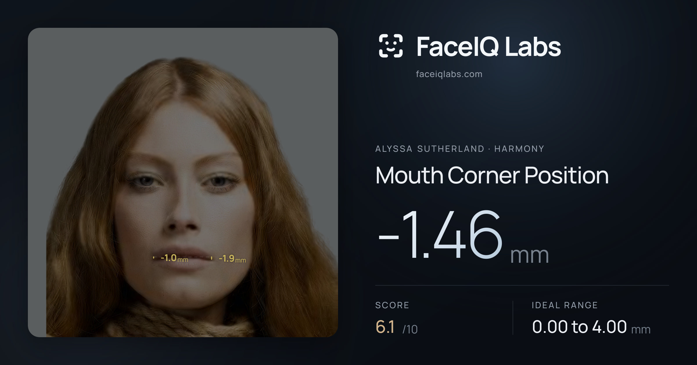 Alyssa Sutherland Mouth Corner Position: -1.46mm, drawn on the photo