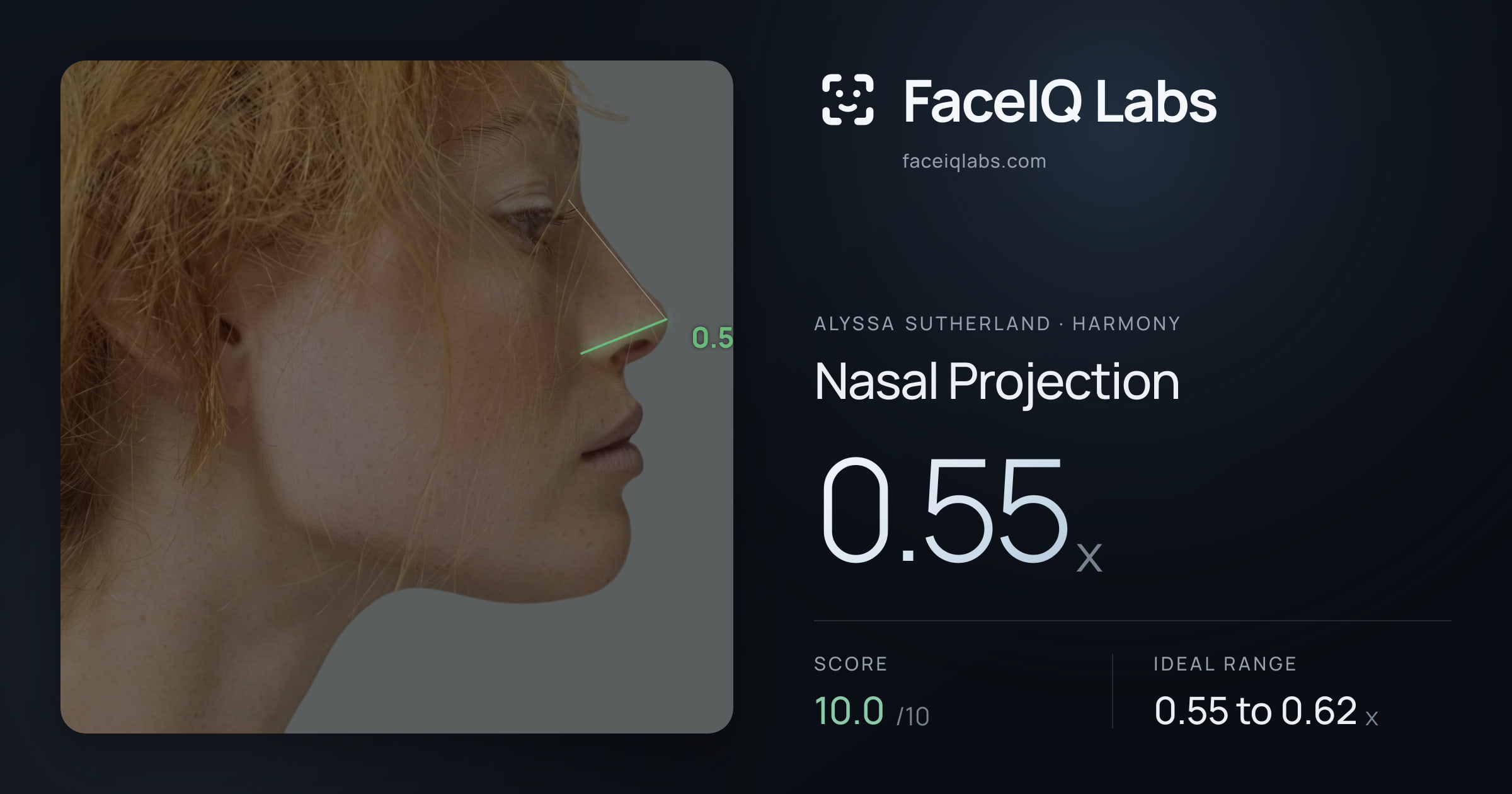 Alyssa Sutherland Nasal Projection: 0.55x, drawn on the photo