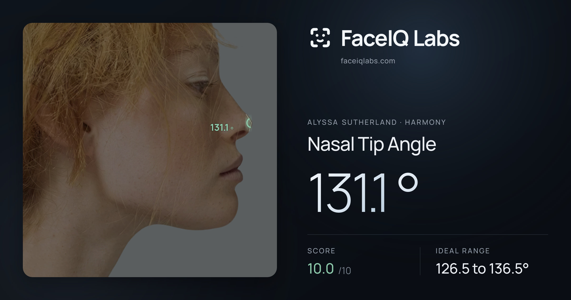 Alyssa Sutherland Nasal Tip Angle: 131.1°, drawn on the photo
