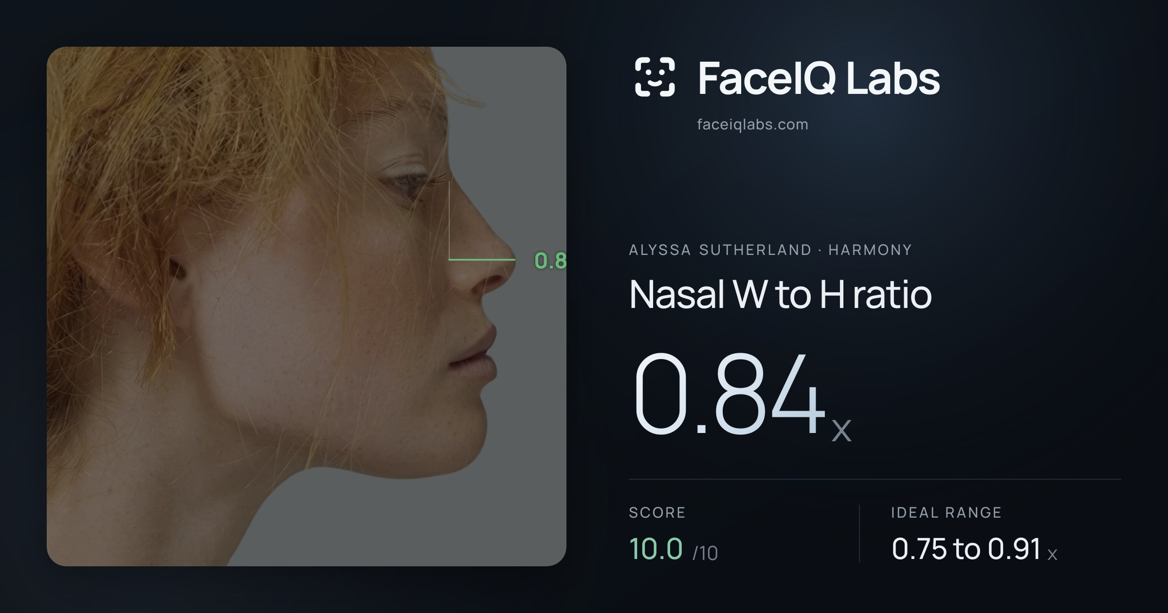 Alyssa Sutherland Nasal W to H ratio: 0.84x, drawn on the photo