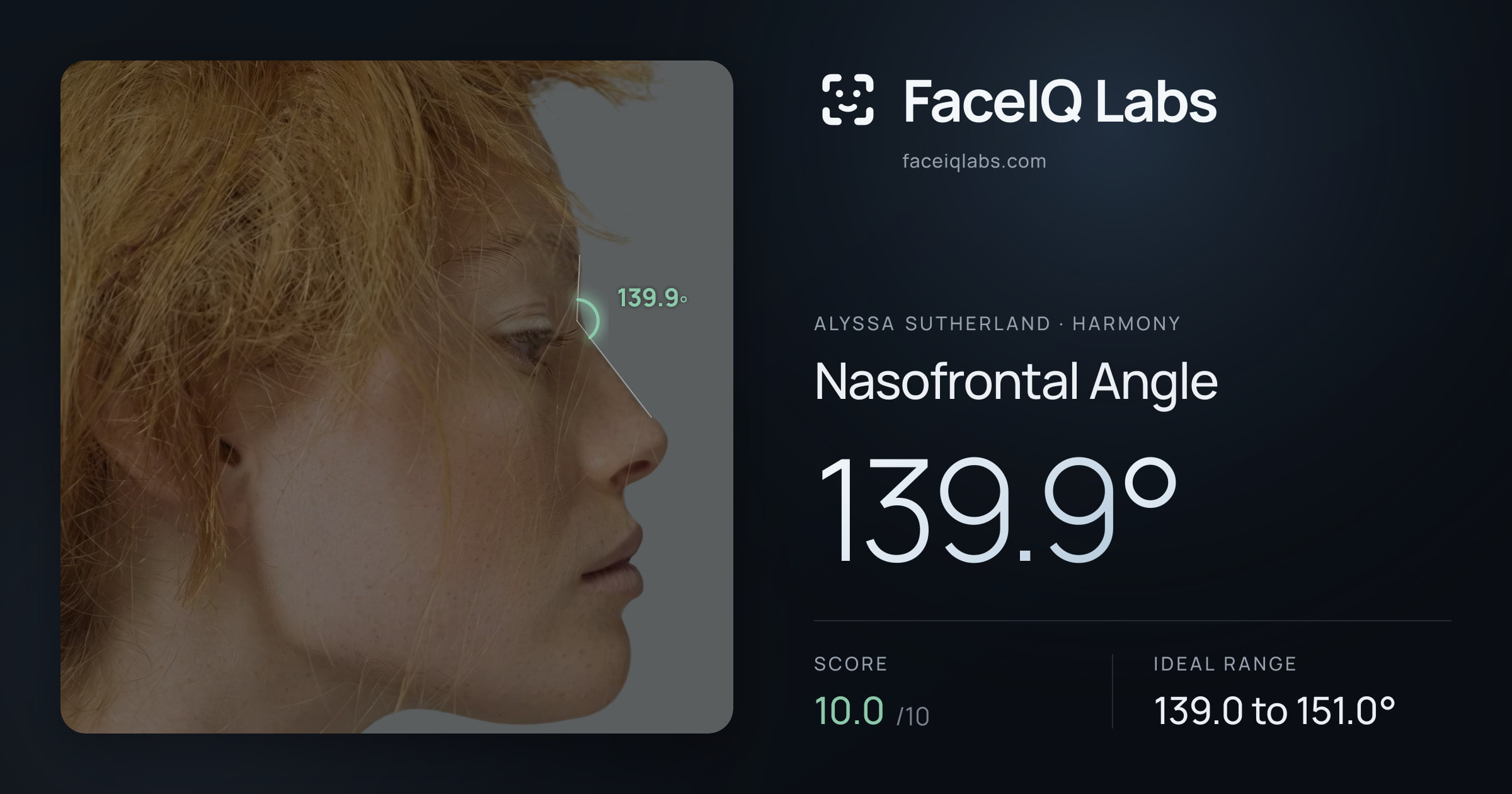 Alyssa Sutherland Nasofrontal Angle: 139.9°, drawn on the photo