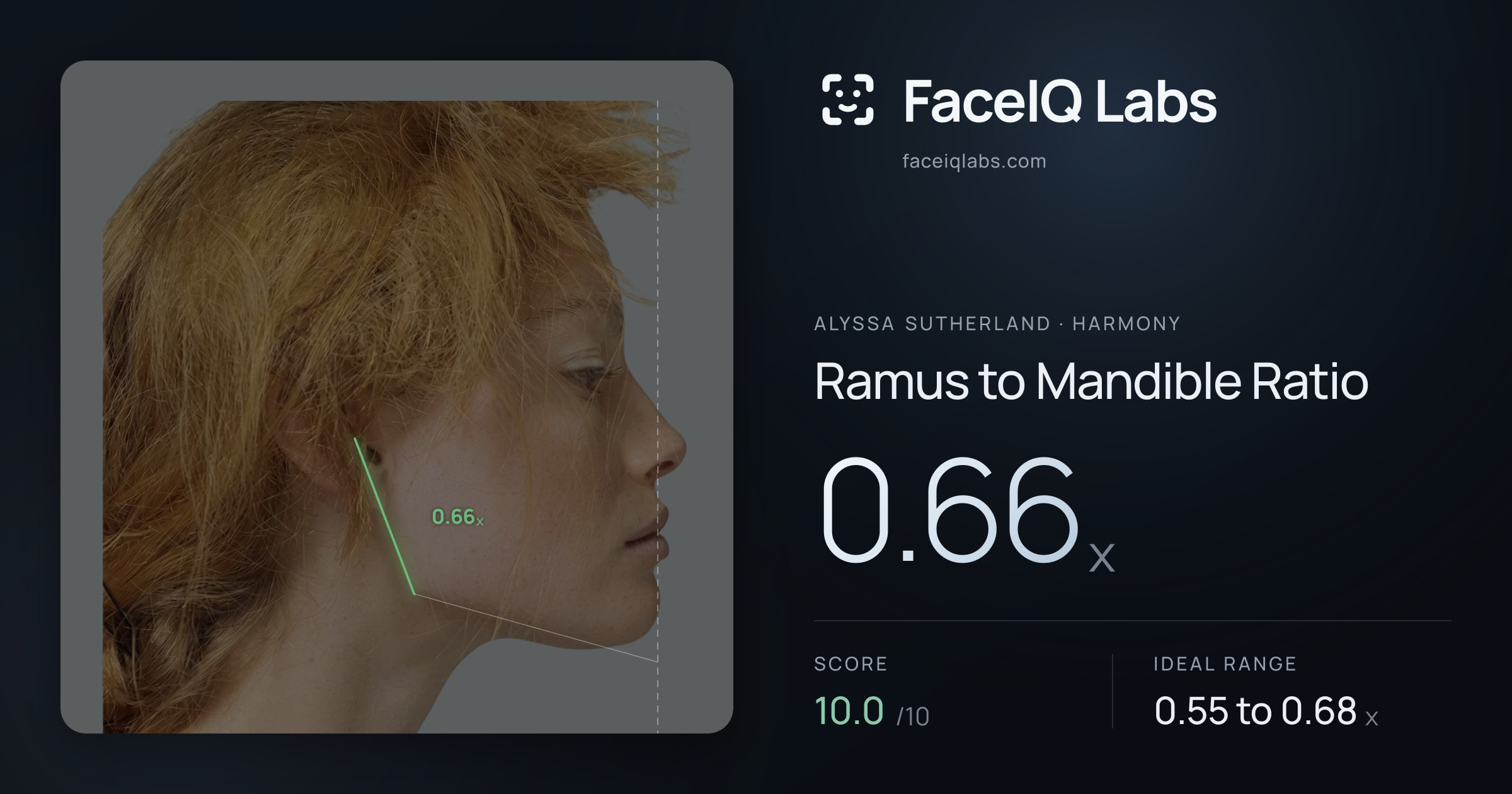 Alyssa Sutherland Ramus to Mandible Ratio: 0.66x, drawn on the photo