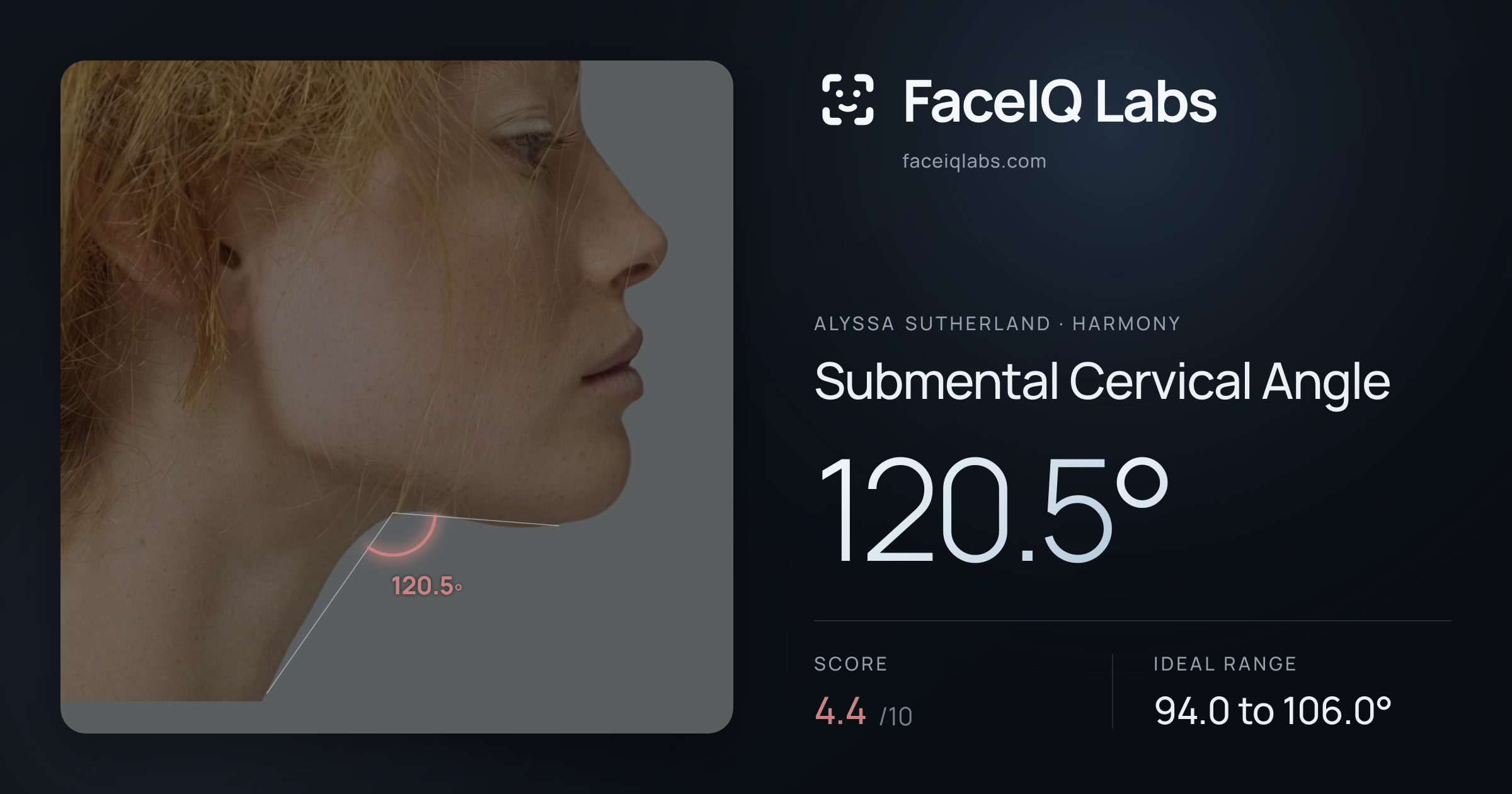 Alyssa Sutherland Submental Cervical Angle: 120.5°, drawn on the photo