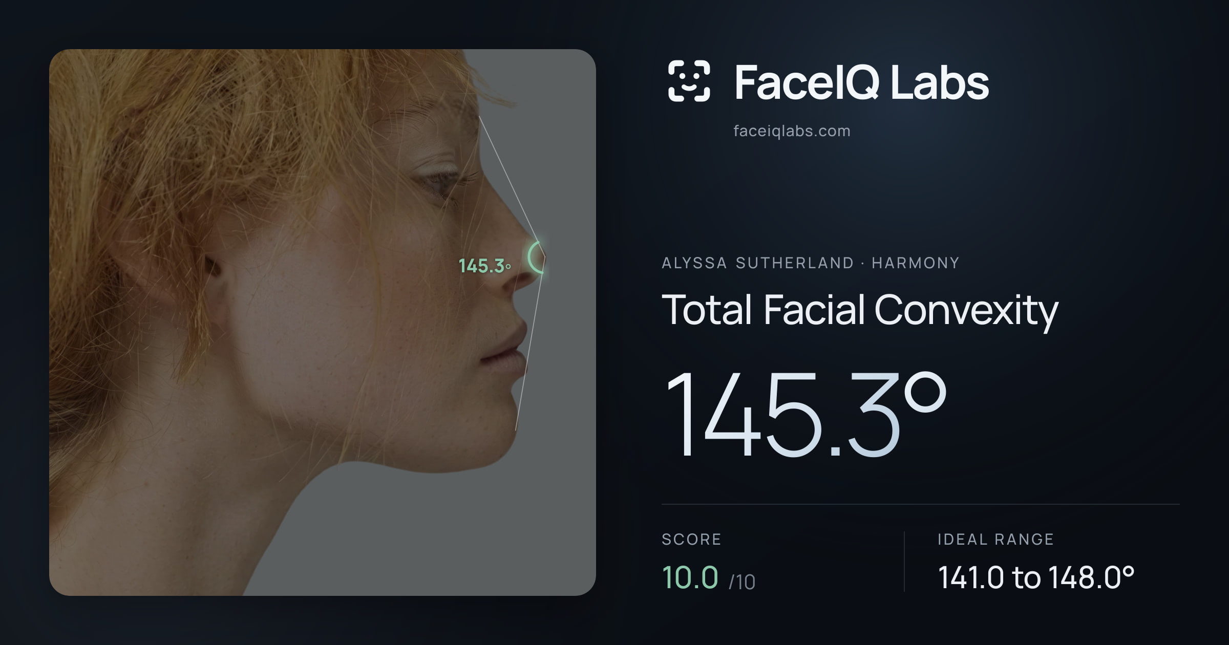 Alyssa Sutherland Total Facial Convexity: 145.3°, drawn on the photo