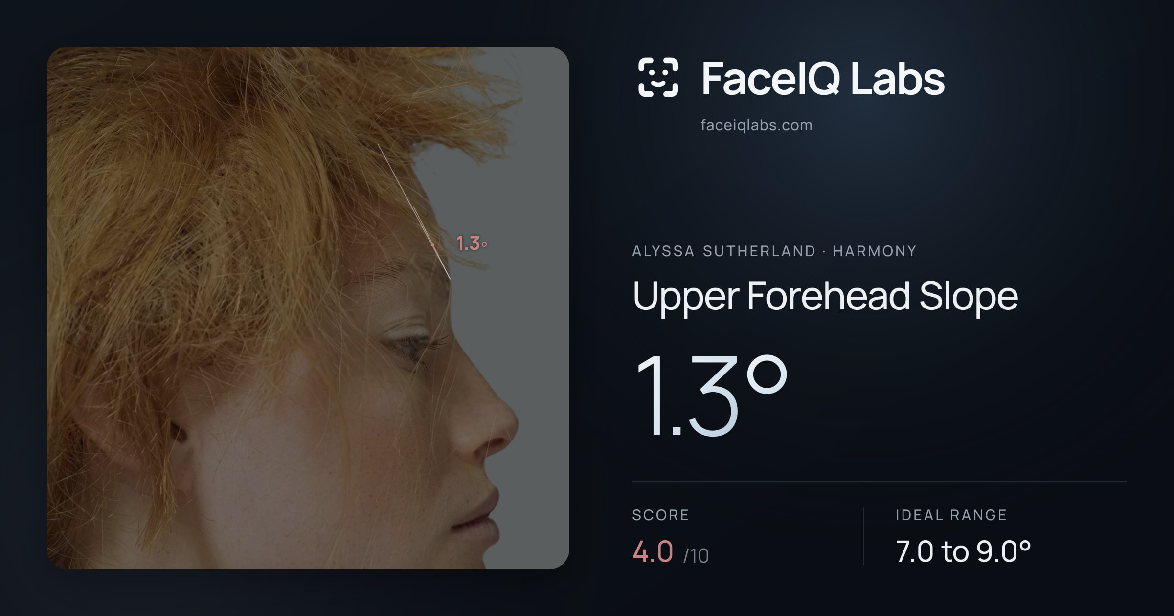 Alyssa Sutherland Upper Forehead Slope: 1.3°, drawn on the photo