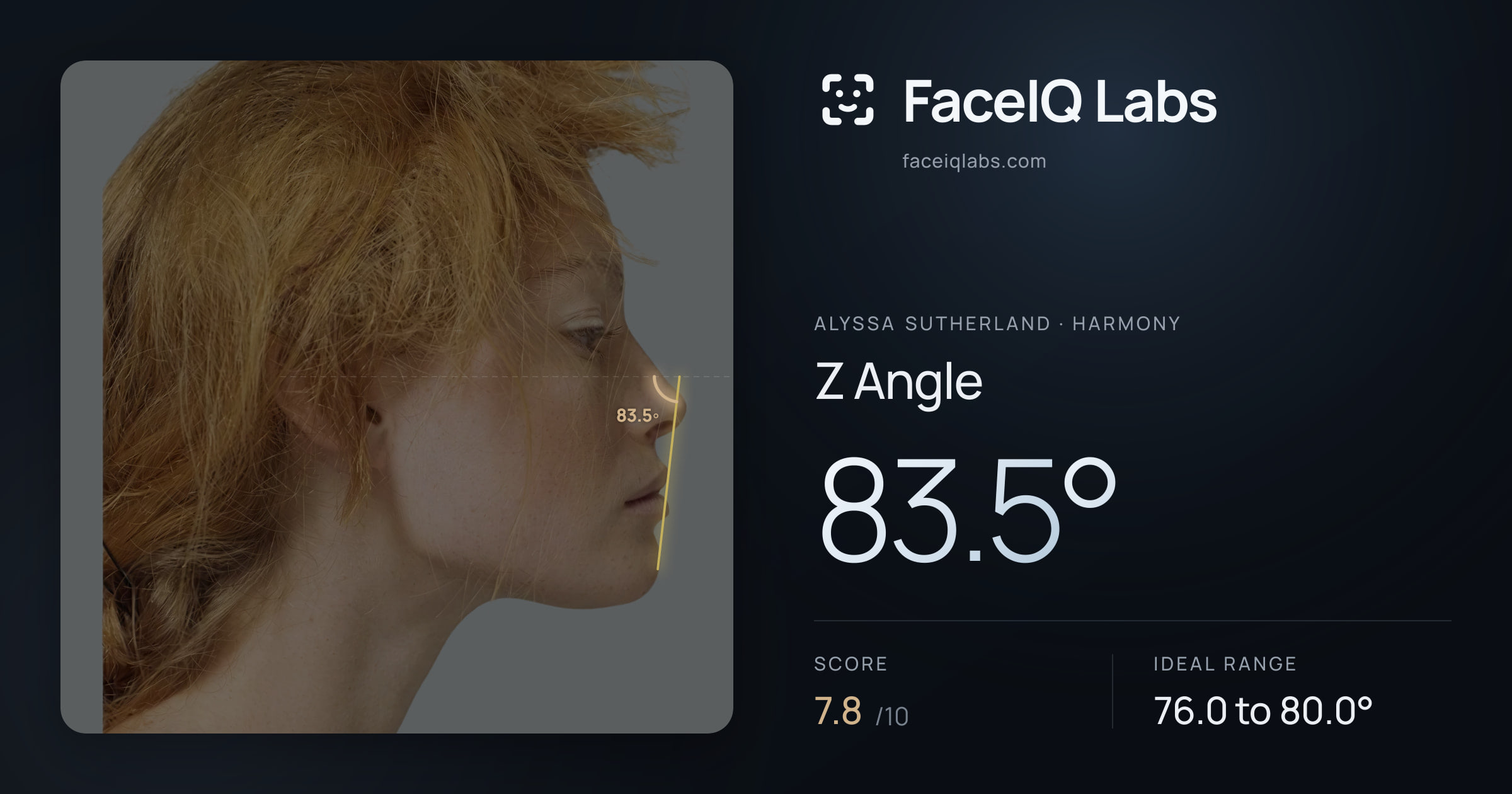Alyssa Sutherland Z Angle: 83.5°, drawn on the photo