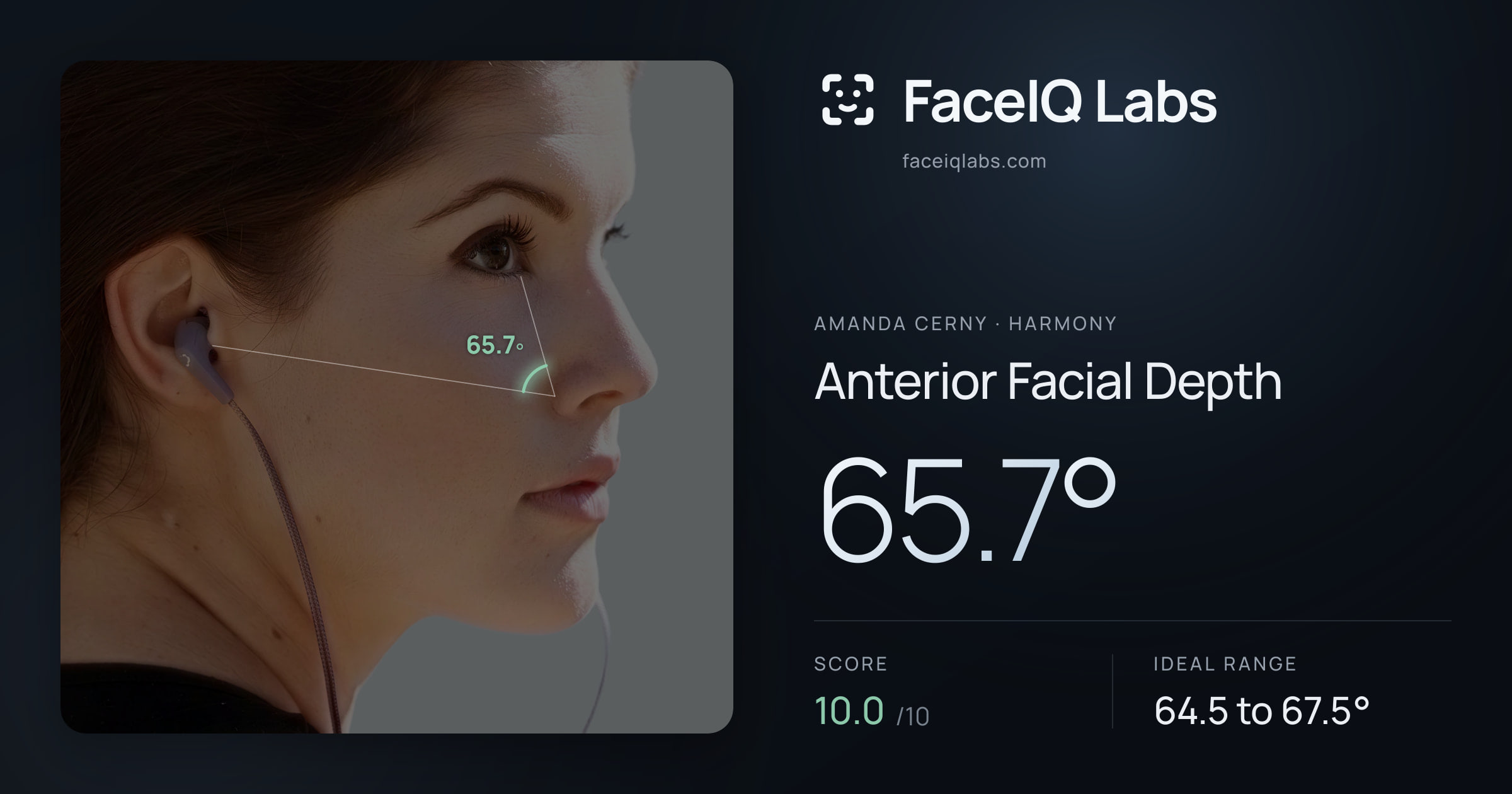 Amanda Cerny Anterior Facial Depth: 65.7°, drawn on the photo