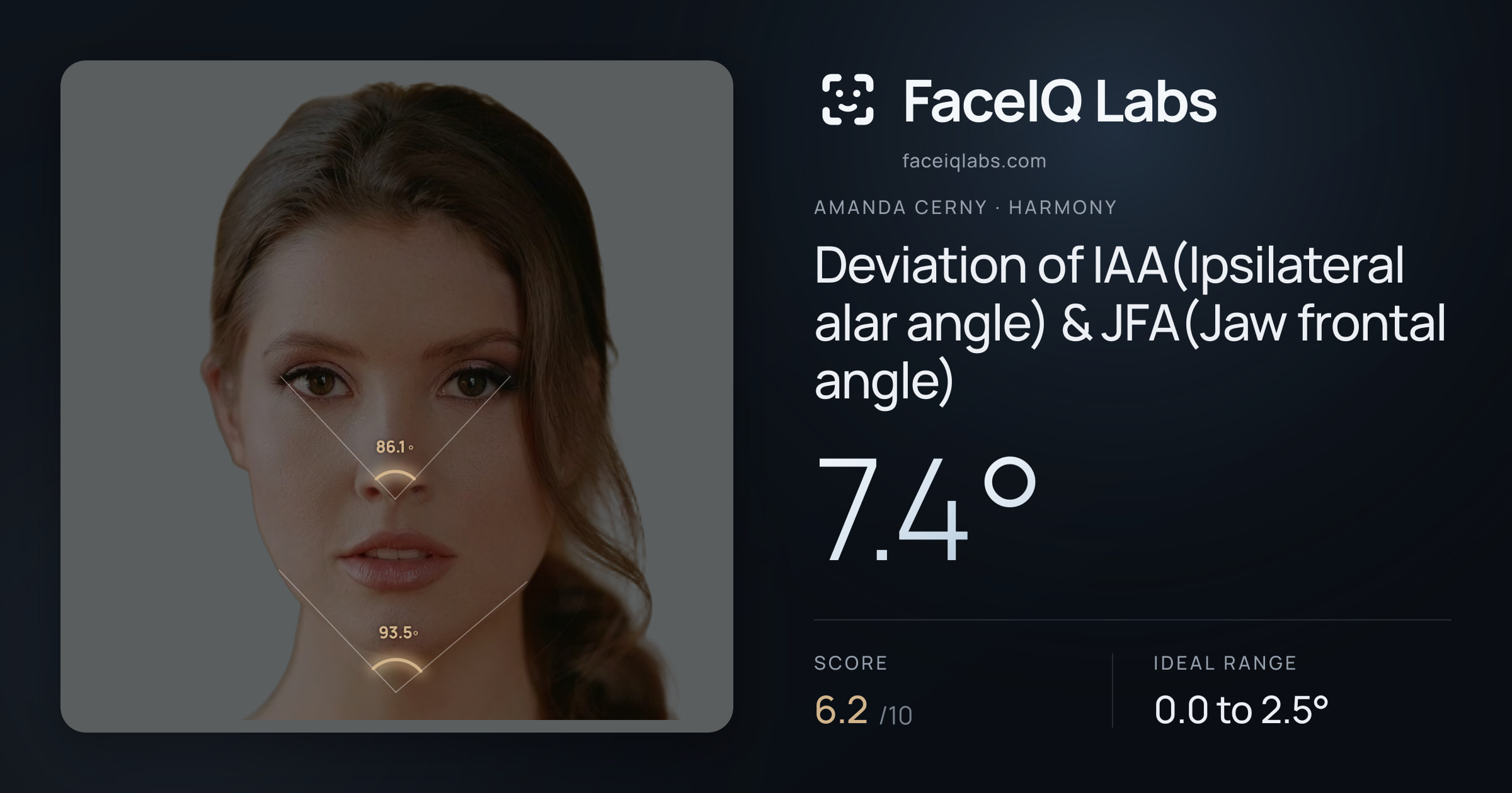 Amanda Cerny Deviation of IAA(Ipsilateral alar angle) & JFA(Jaw frontal angle): 7.4°, drawn on the photo