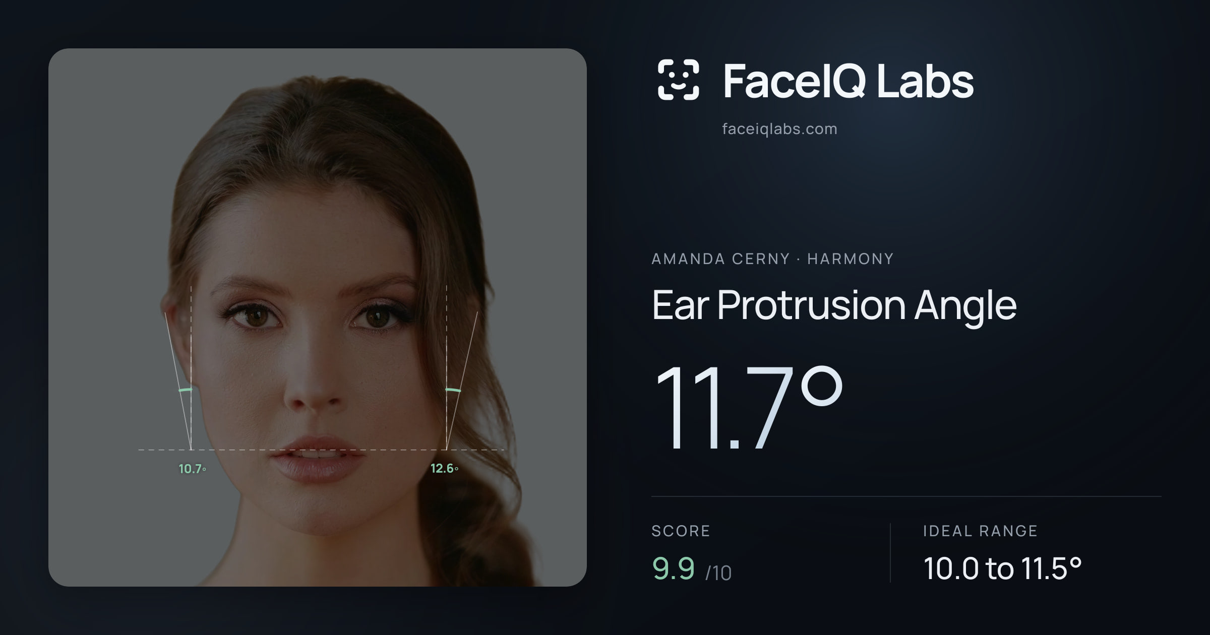Amanda Cerny Ear Protrusion Angle: 11.7°, drawn on the photo