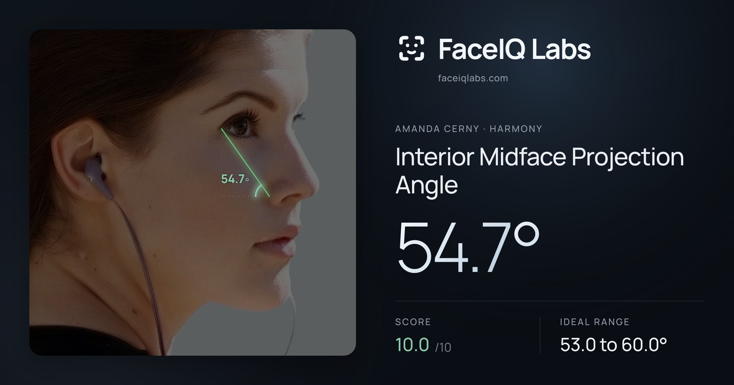 Amanda Cerny Interior Midface Projection Angle: 54.7°, drawn on the photo
