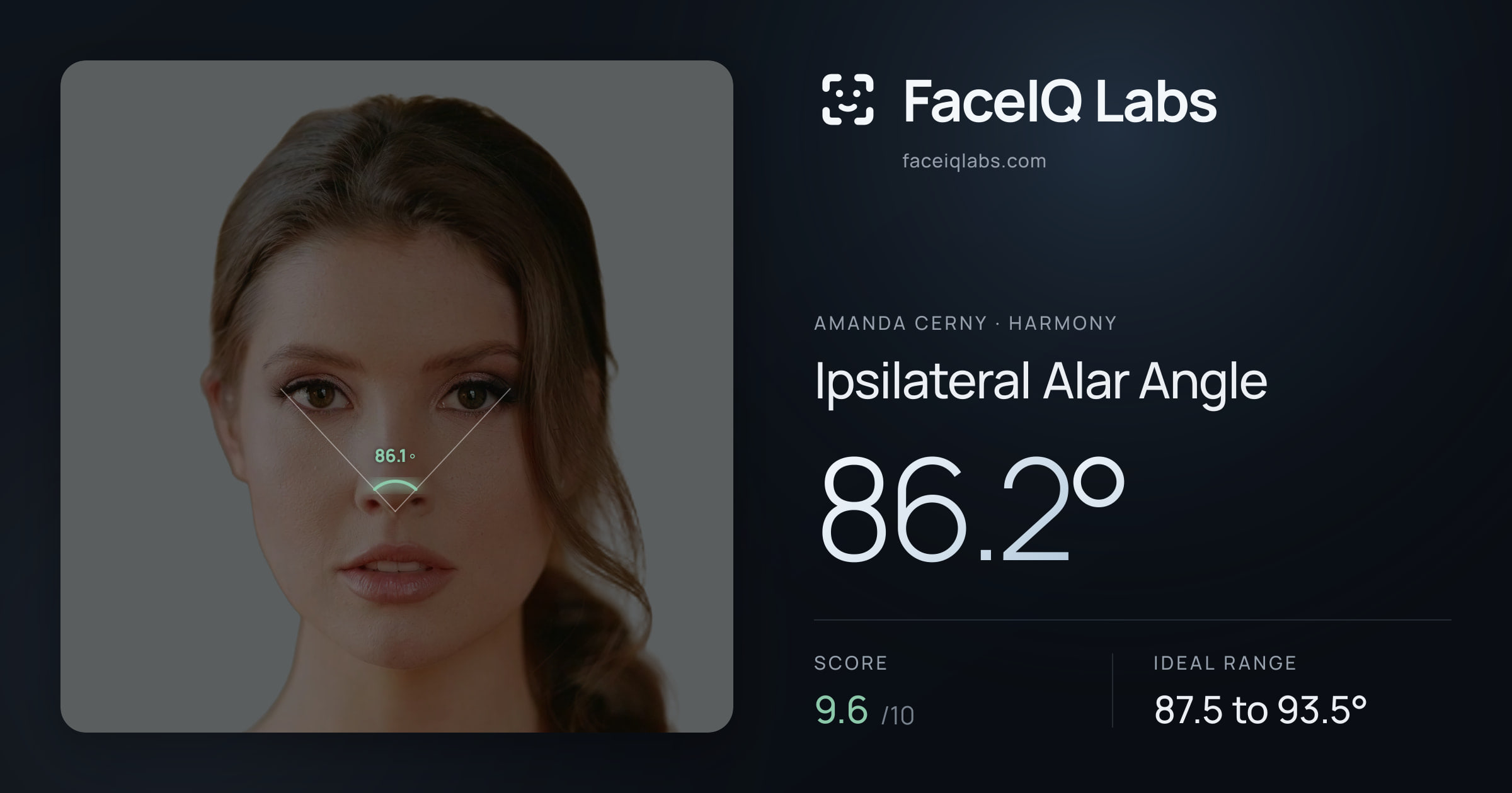 Amanda Cerny Ipsilateral Alar Angle: 86.2°, drawn on the photo
