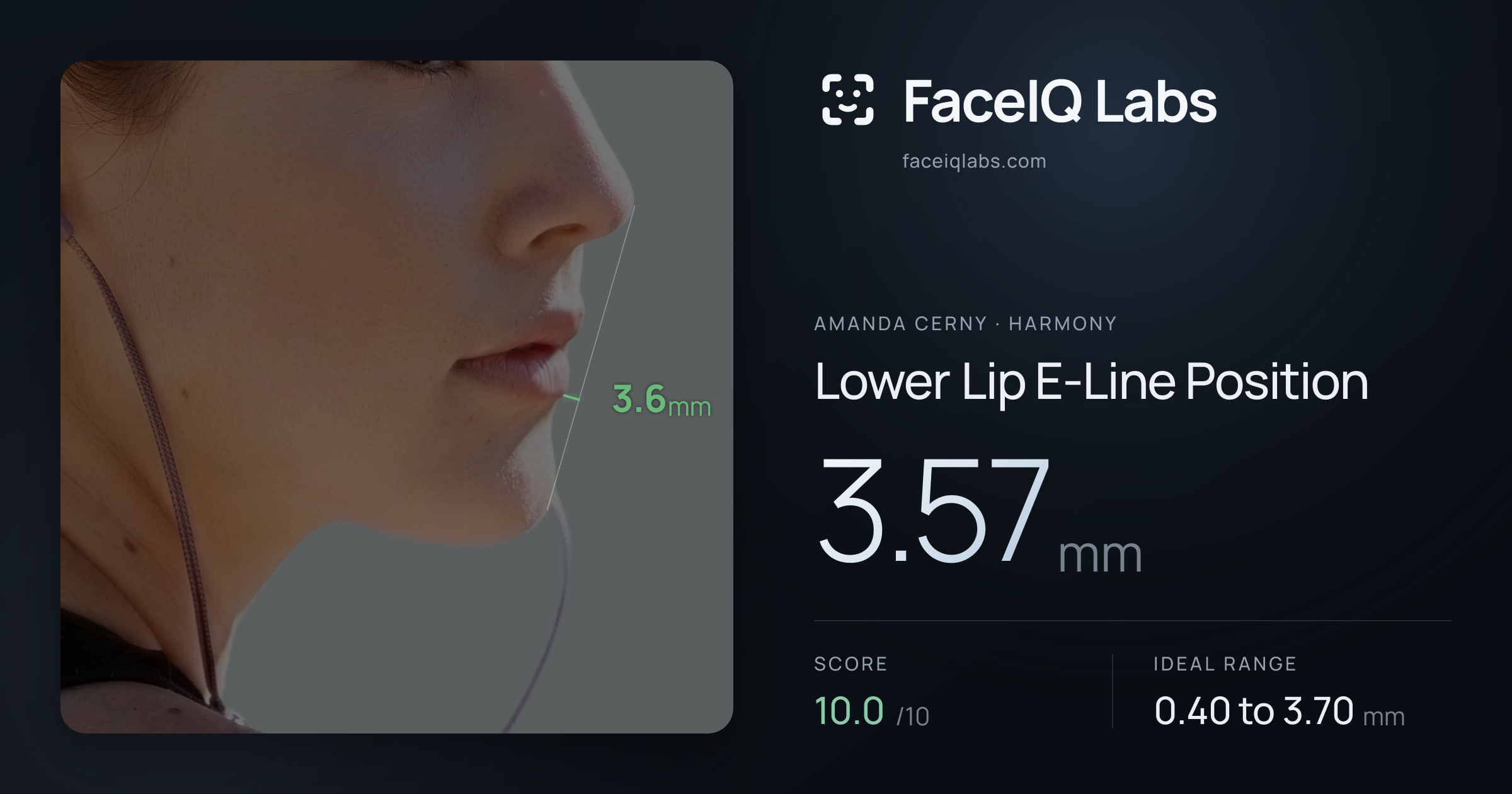 Amanda Cerny Lower Lip E-Line Position: 3.57mm, drawn on the photo
