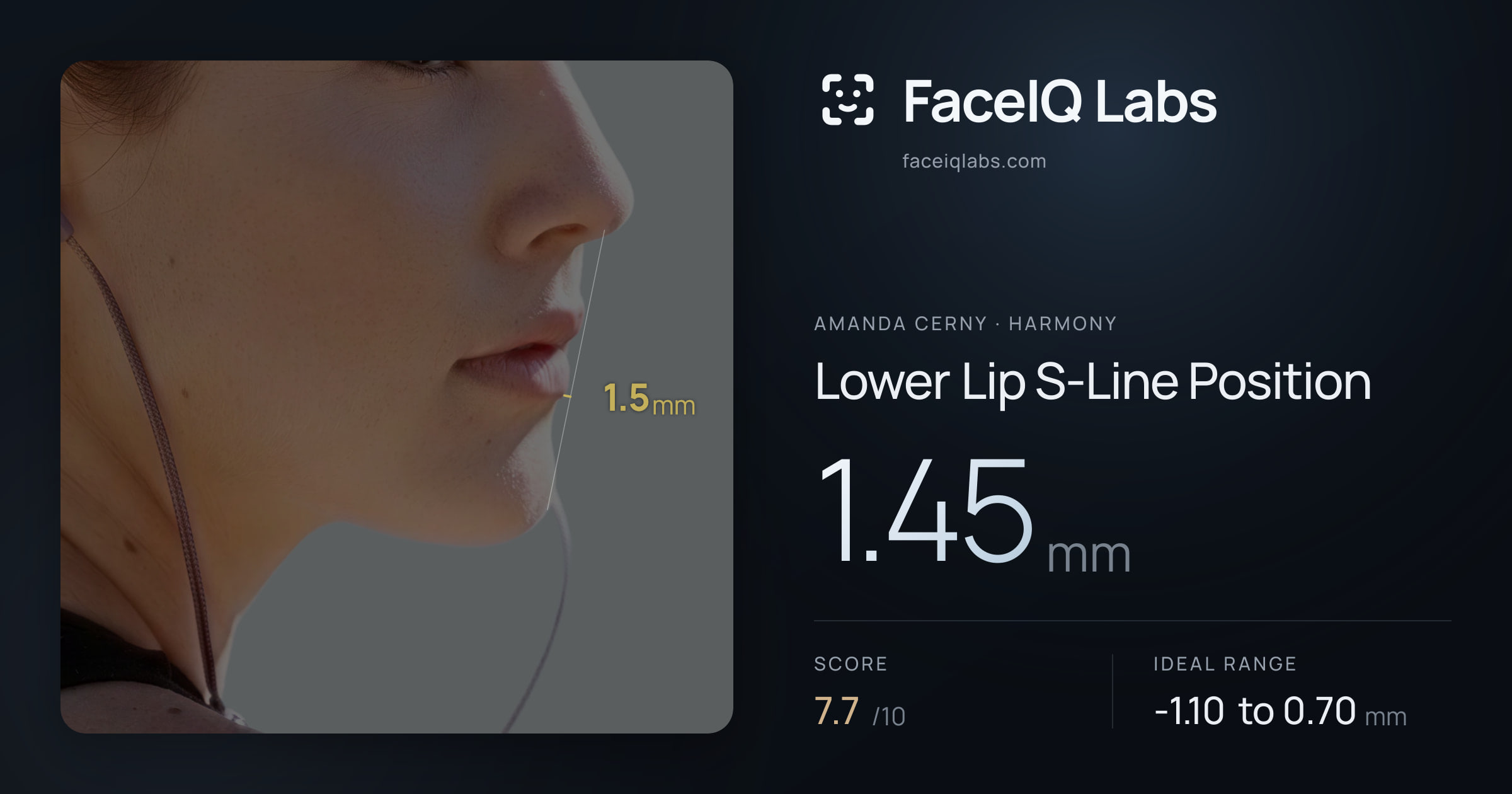 Amanda Cerny Lower Lip S-Line Position: 1.45mm, drawn on the photo