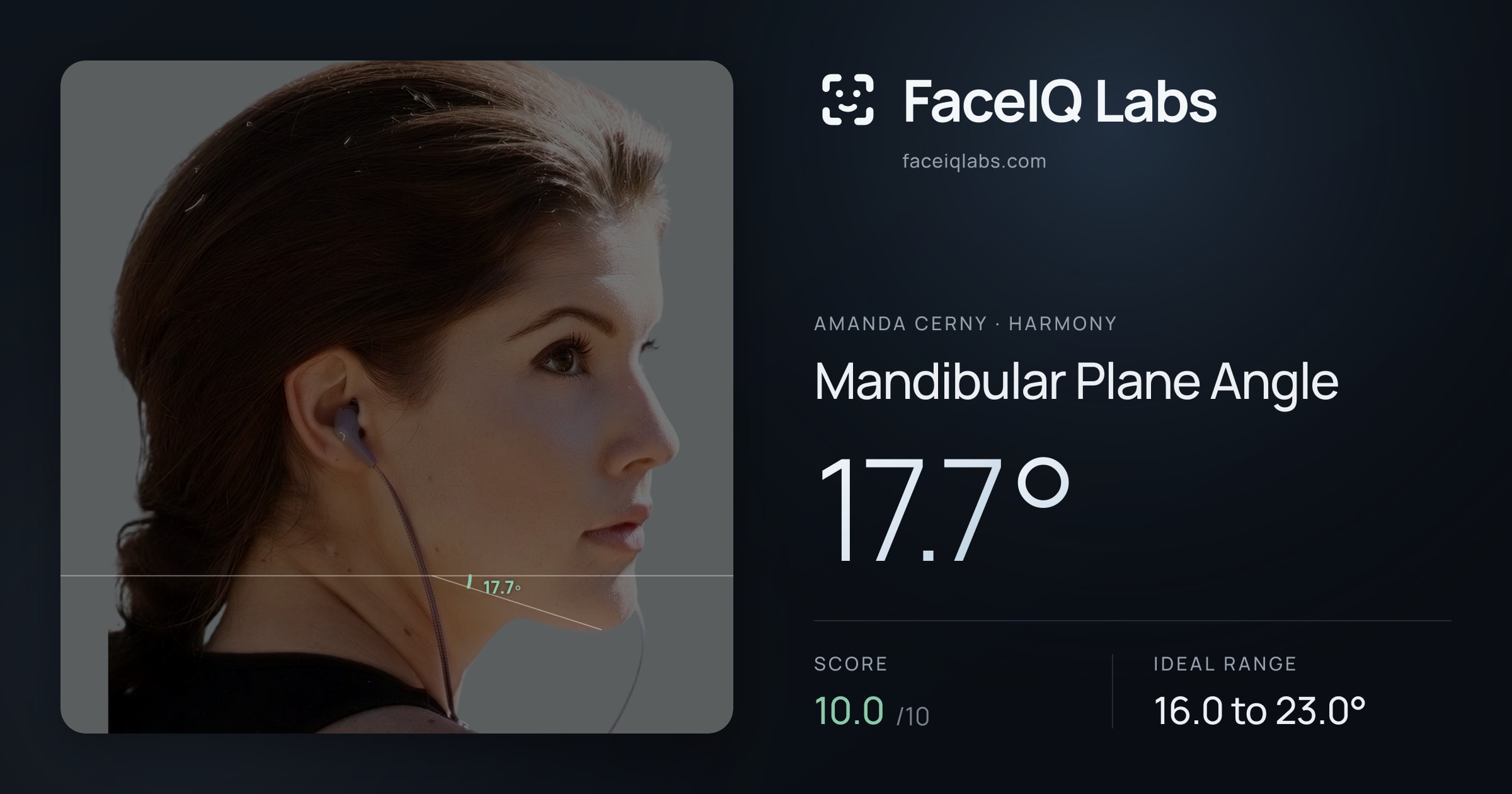 Amanda Cerny Mandibular Plane Angle: 17.7°, drawn on the photo
