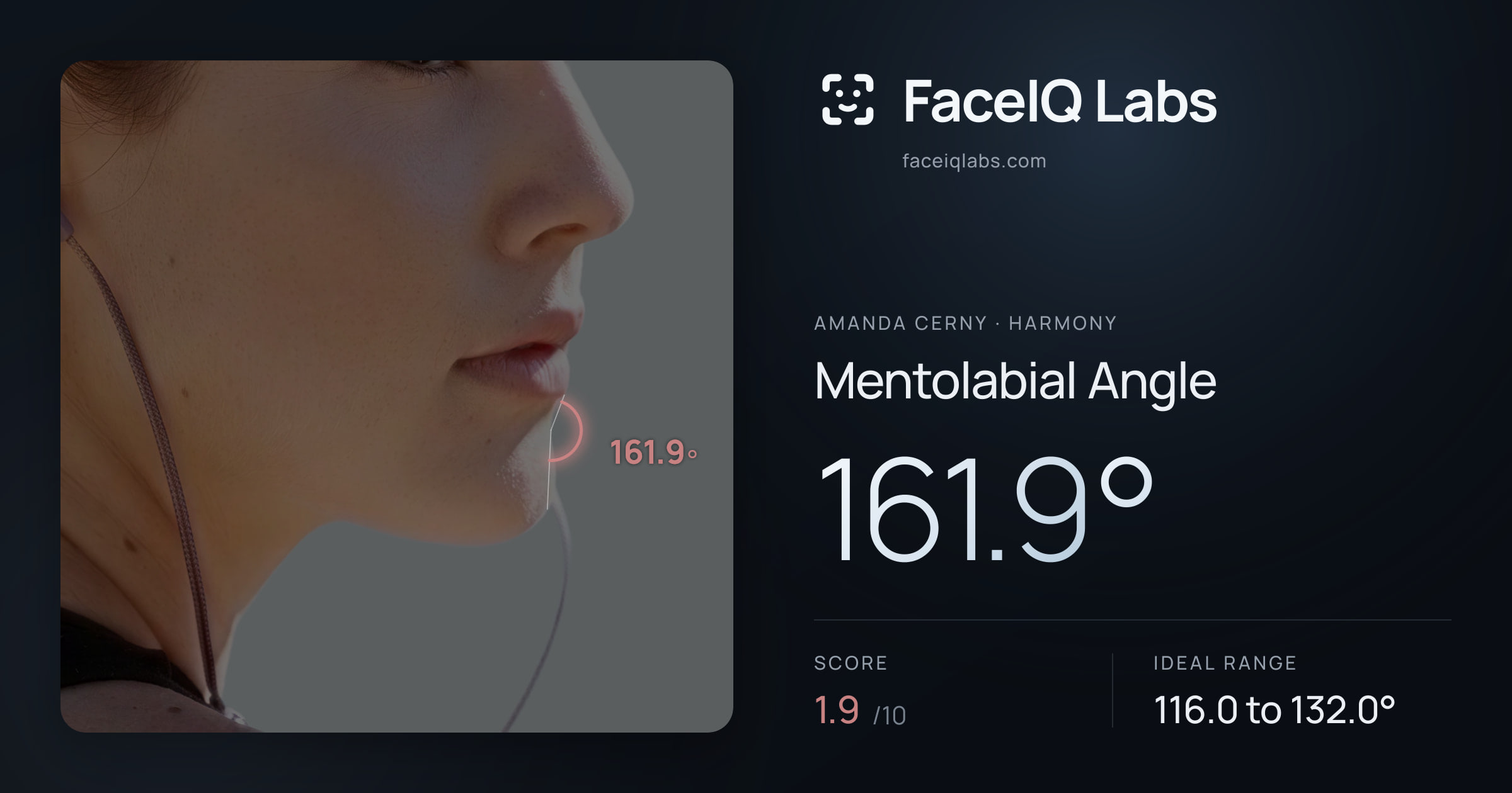 Amanda Cerny Mentolabial Angle: 161.9°, drawn on the photo
