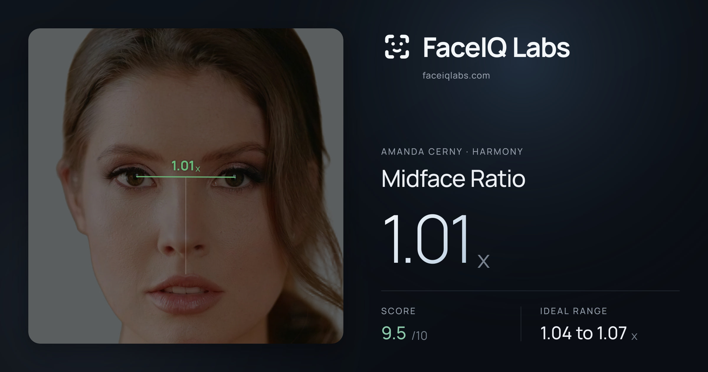 Amanda Cerny Midface Ratio: 1.01x, drawn on the photo