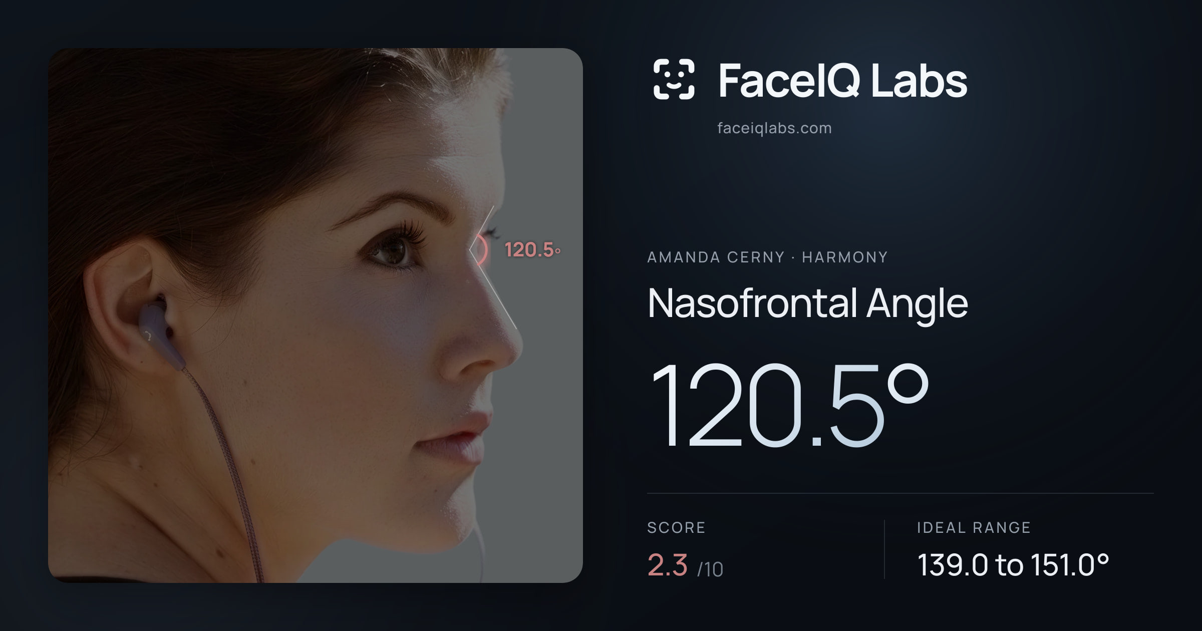 Amanda Cerny Nasofrontal Angle: 120.5°, drawn on the photo