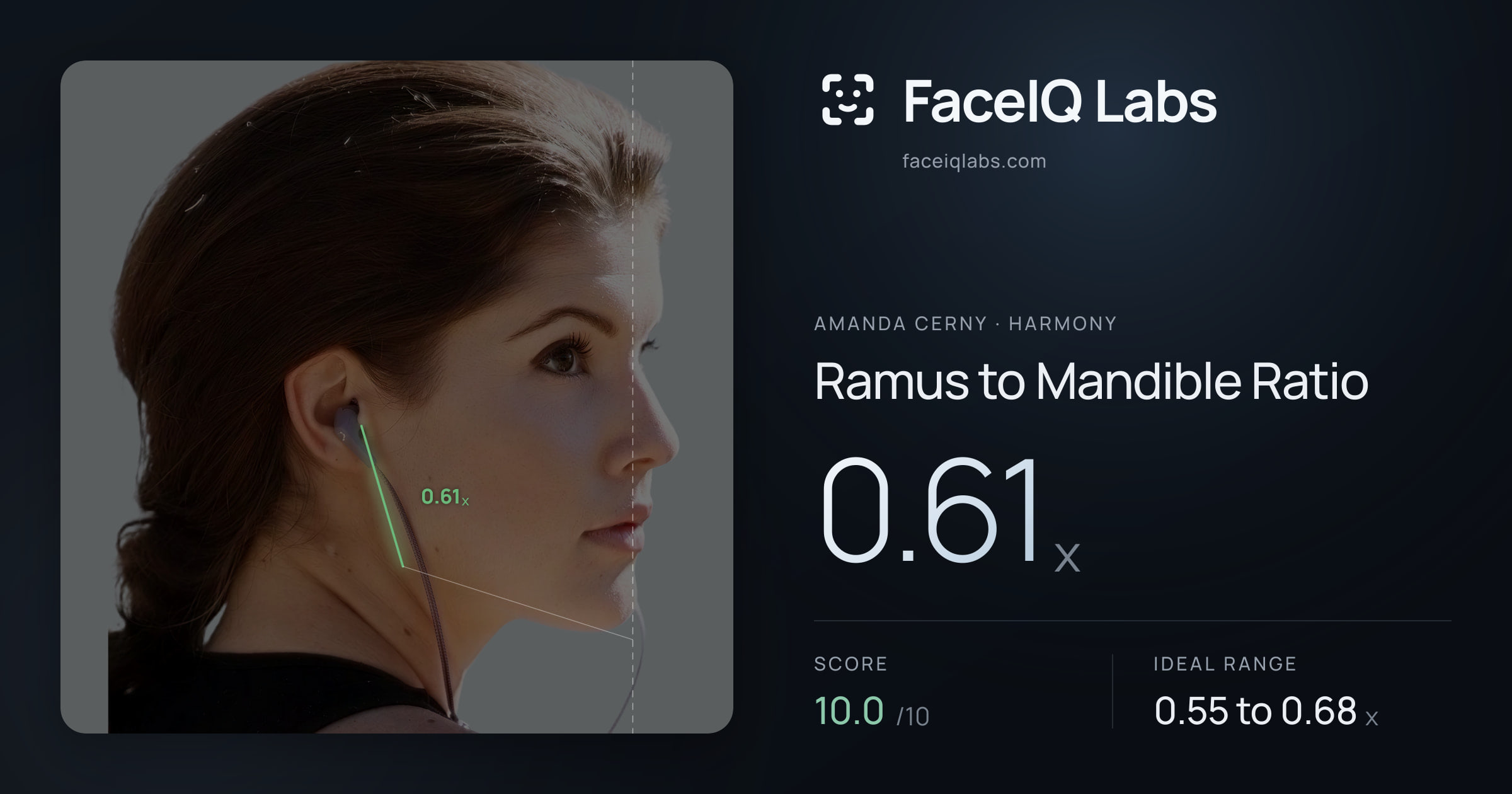 Amanda Cerny Ramus to Mandible Ratio: 0.61x, drawn on the photo