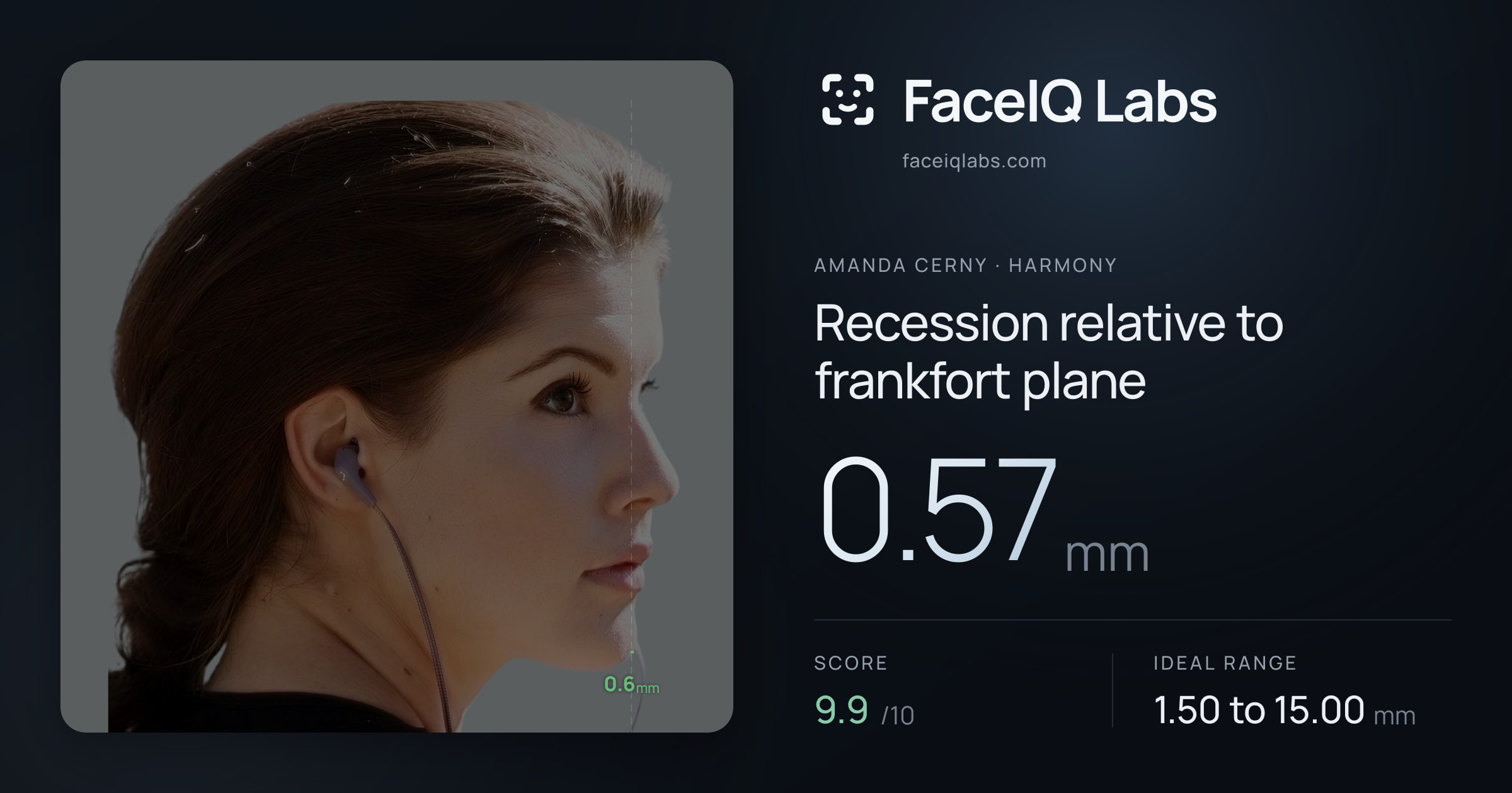 Amanda Cerny Recession relative to frankfort plane: 0.57mm, drawn on the photo