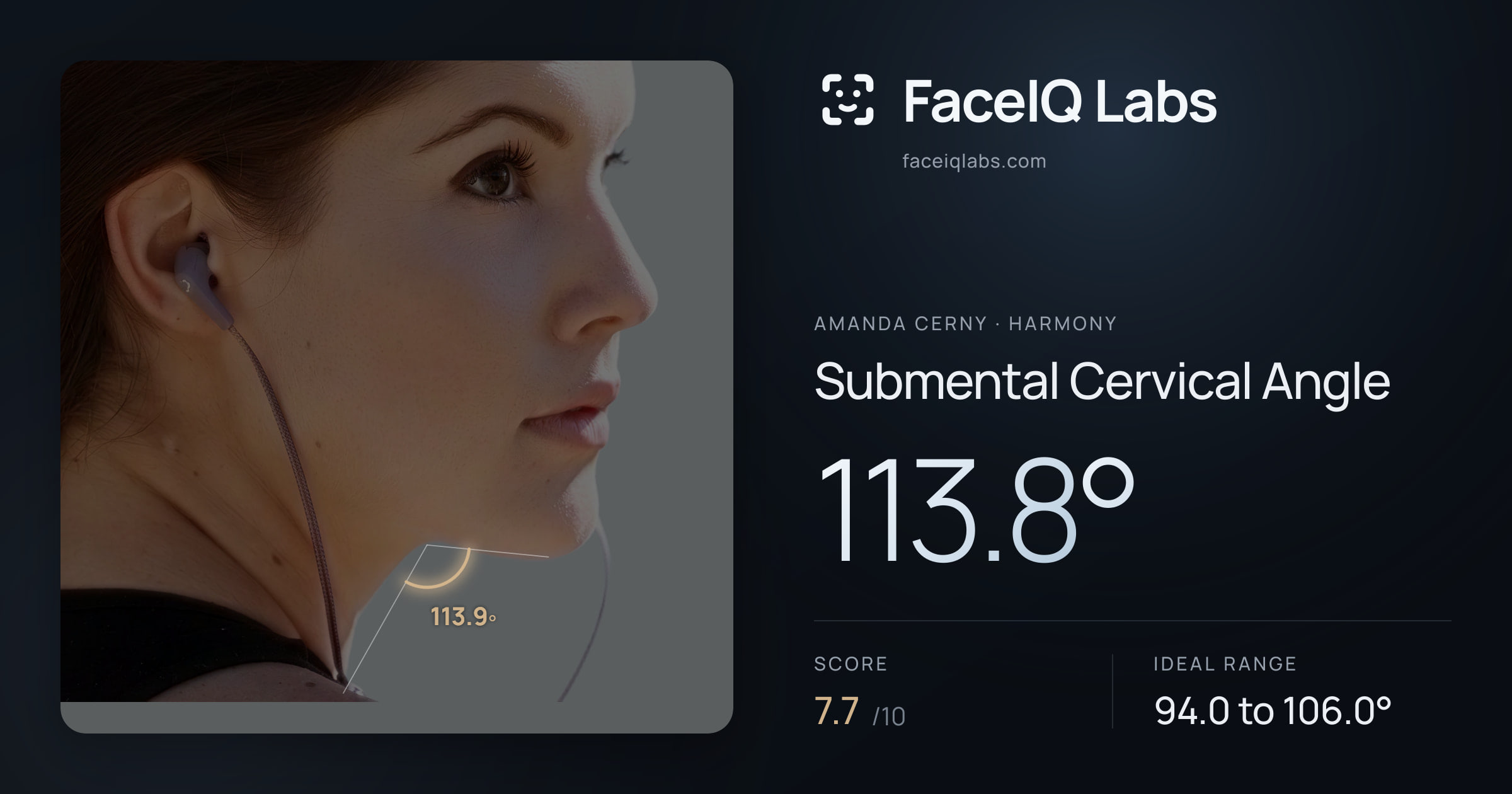 Amanda Cerny Submental Cervical Angle: 113.8°, drawn on the photo