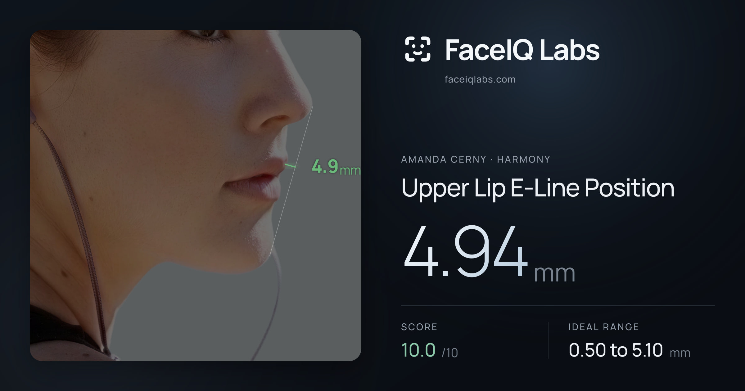 Amanda Cerny Upper Lip E-Line Position: 4.94mm, drawn on the photo