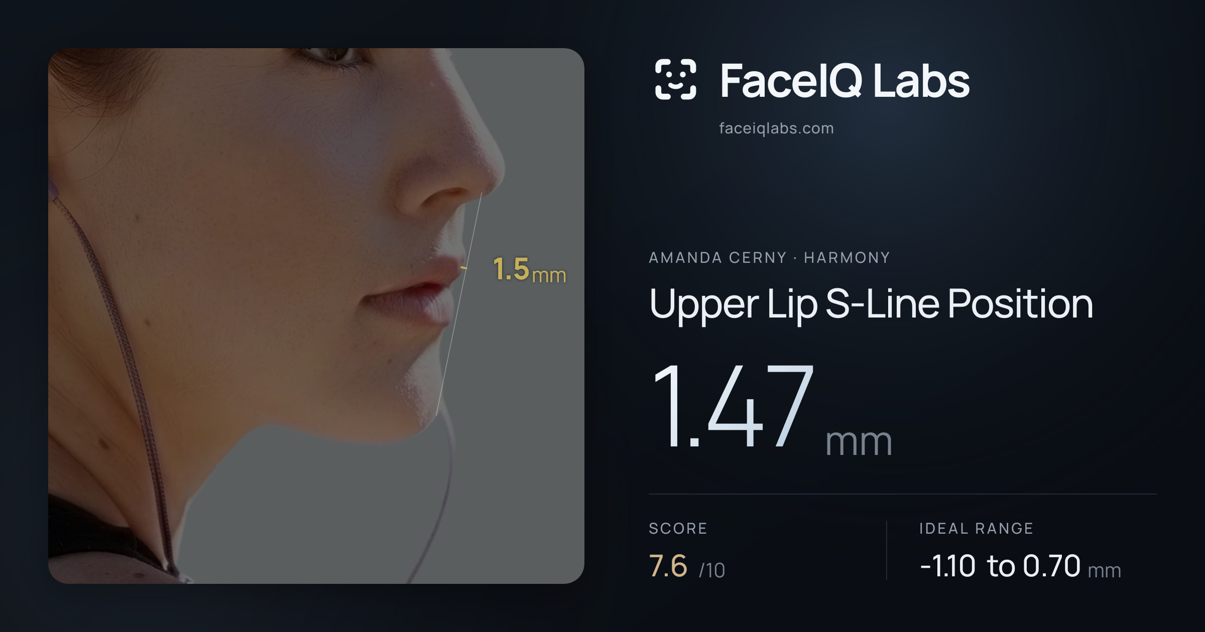 Amanda Cerny Upper Lip S-Line Position: 1.47mm, drawn on the photo