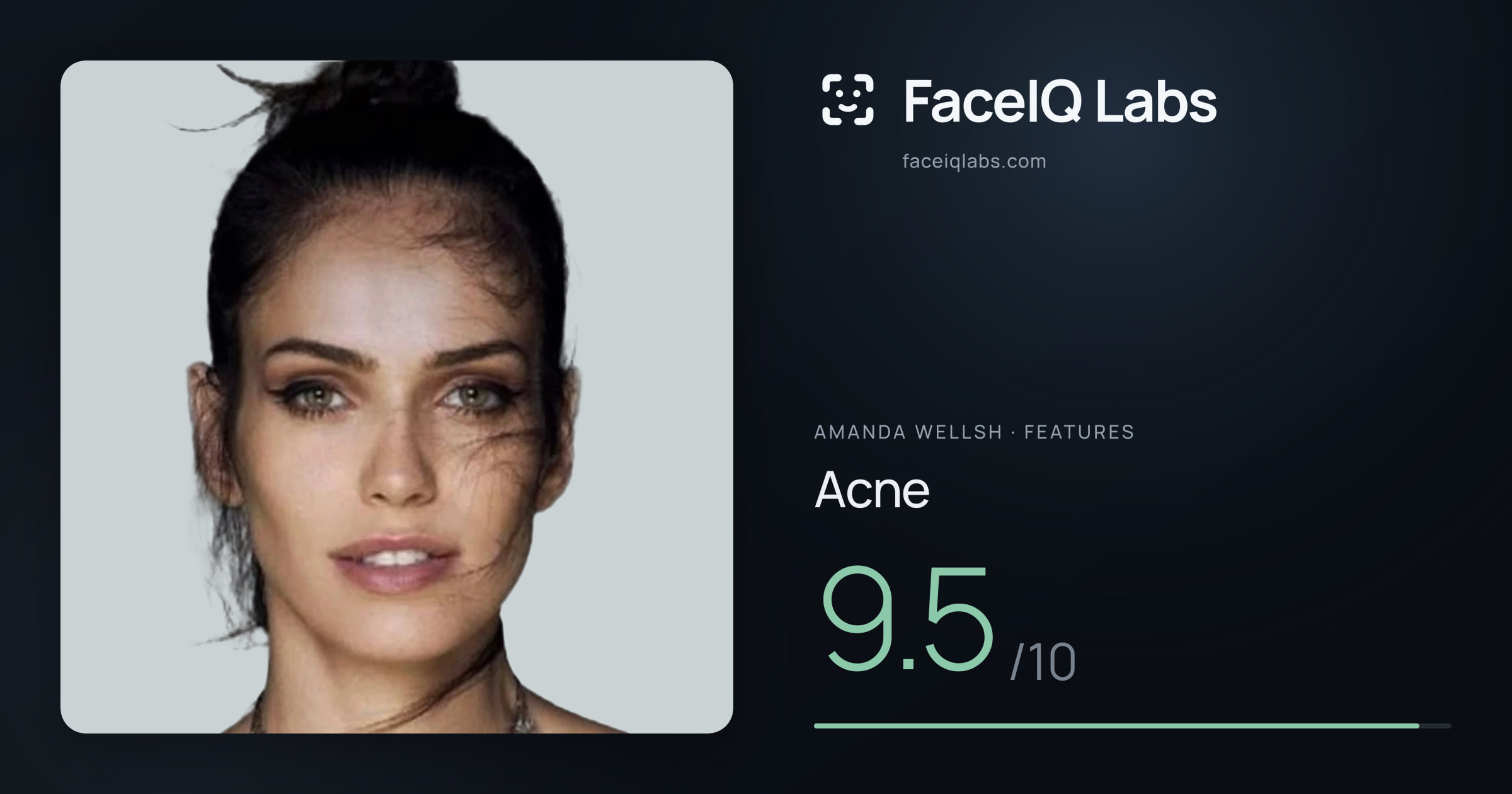 Amanda Wellsh Acne: 9.5/10, drawn on the photo