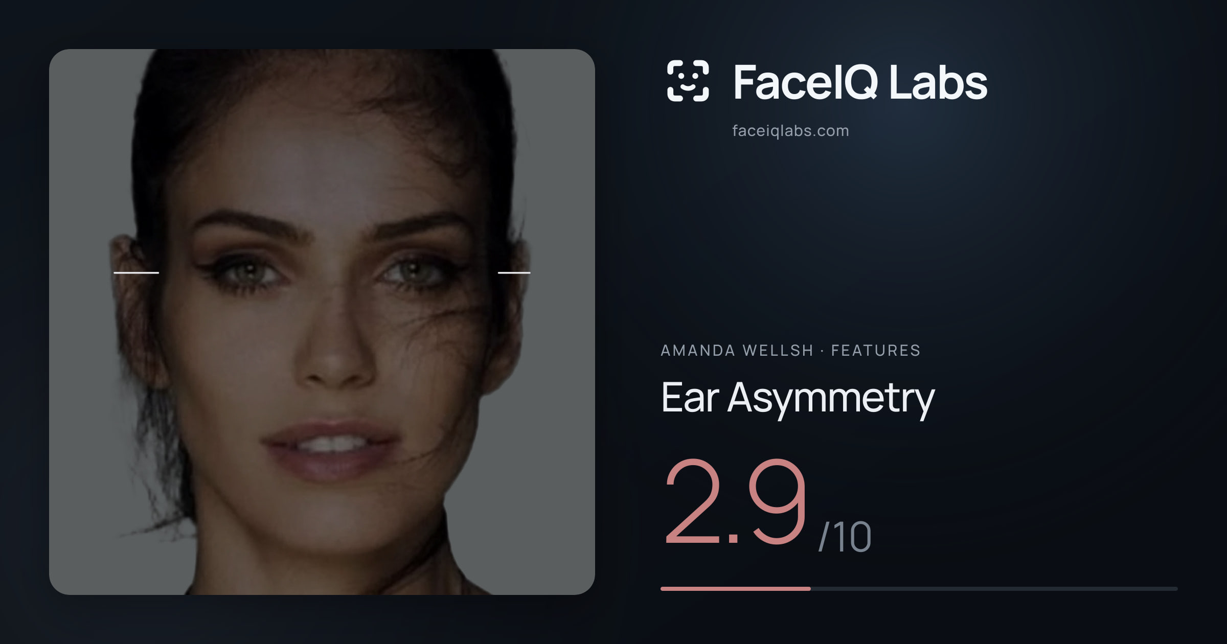 Amanda Wellsh Ear Asymmetry: 2.9/10, drawn on the photo