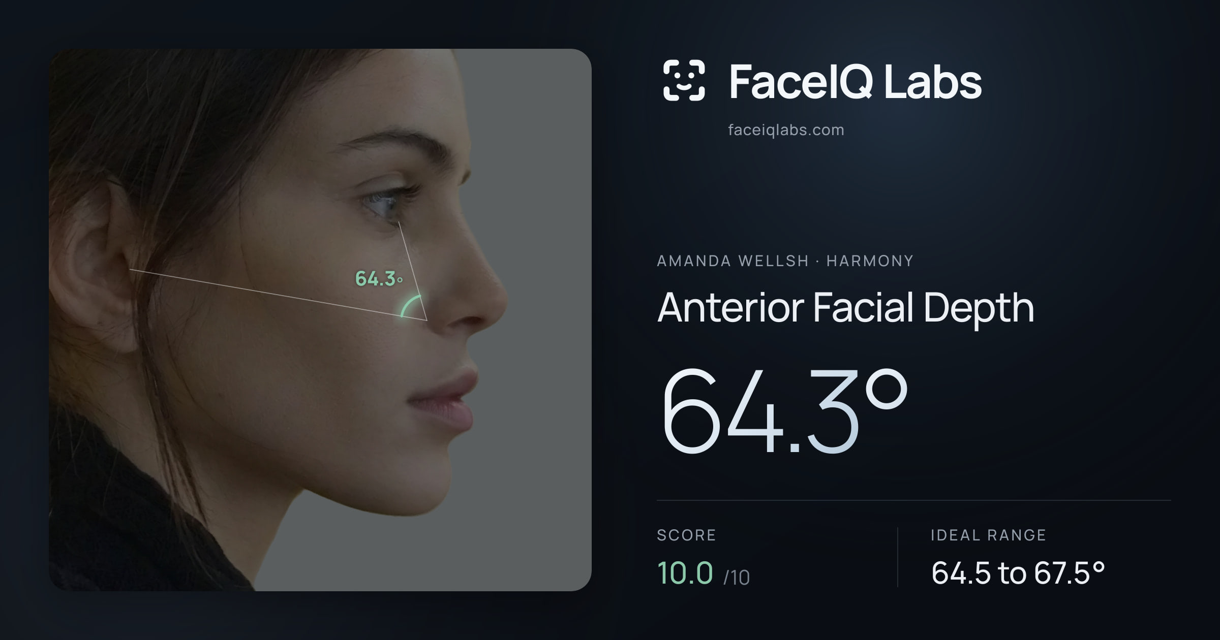 Amanda Wellsh Anterior Facial Depth: 64.3°, drawn on the photo