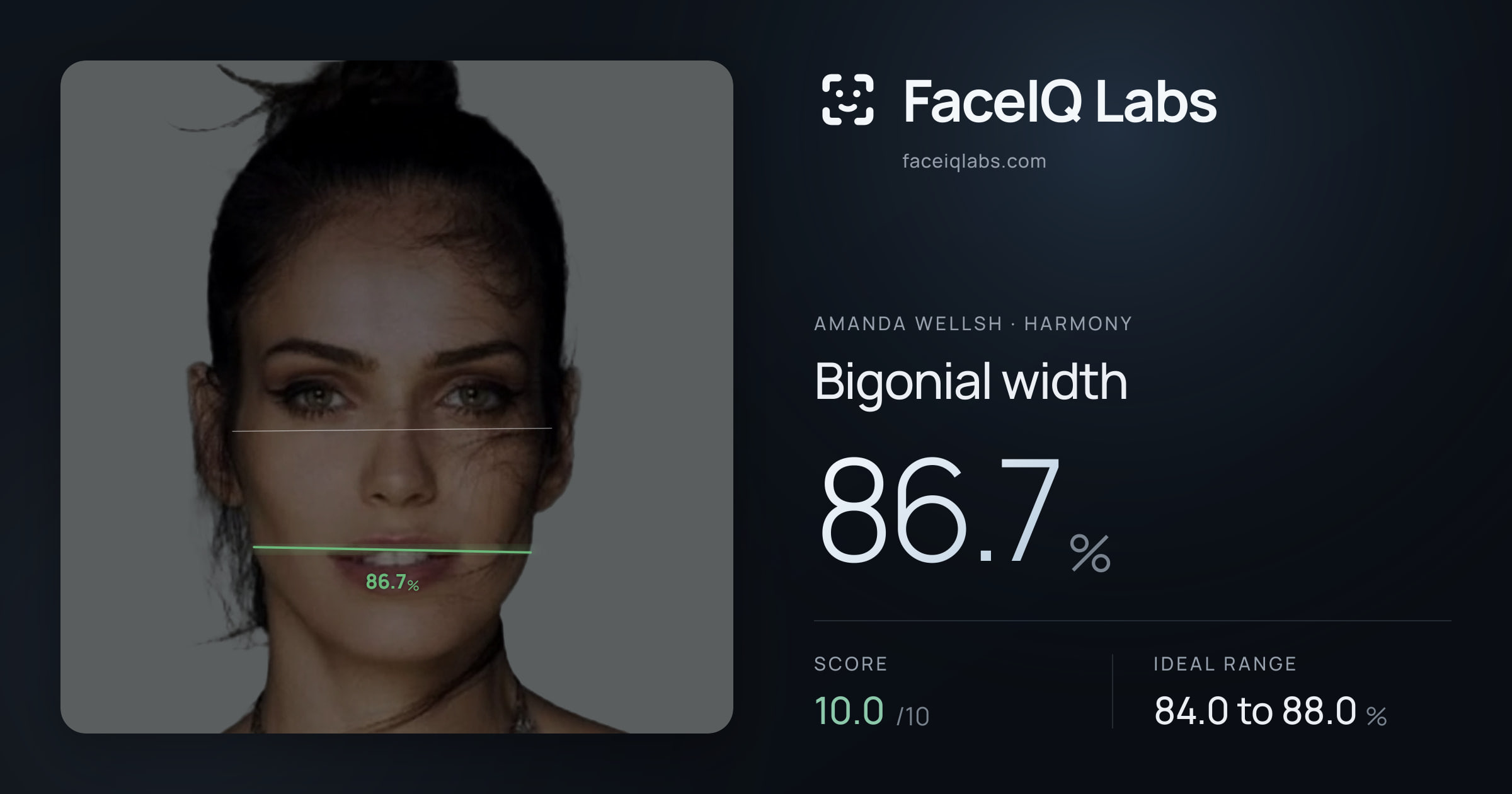 Amanda Wellsh Bigonial width: 86.7%, drawn on the photo