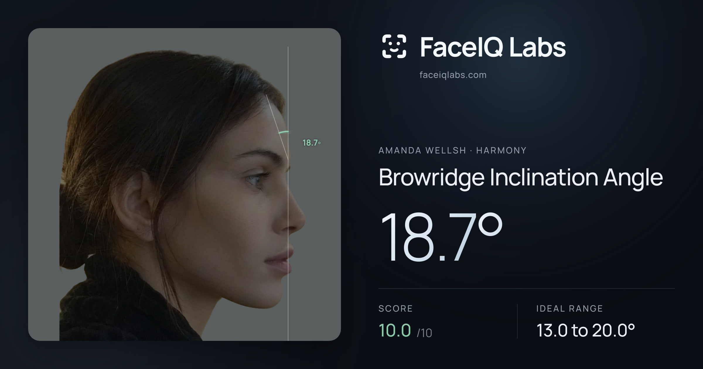 Amanda Wellsh Browridge Inclination Angle: 18.7°, drawn on the photo