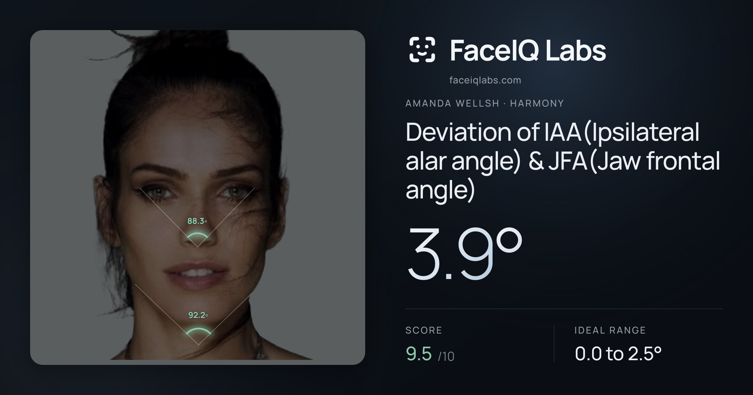 Amanda Wellsh Deviation of IAA(Ipsilateral alar angle) & JFA(Jaw frontal angle): 3.9°, drawn on the photo