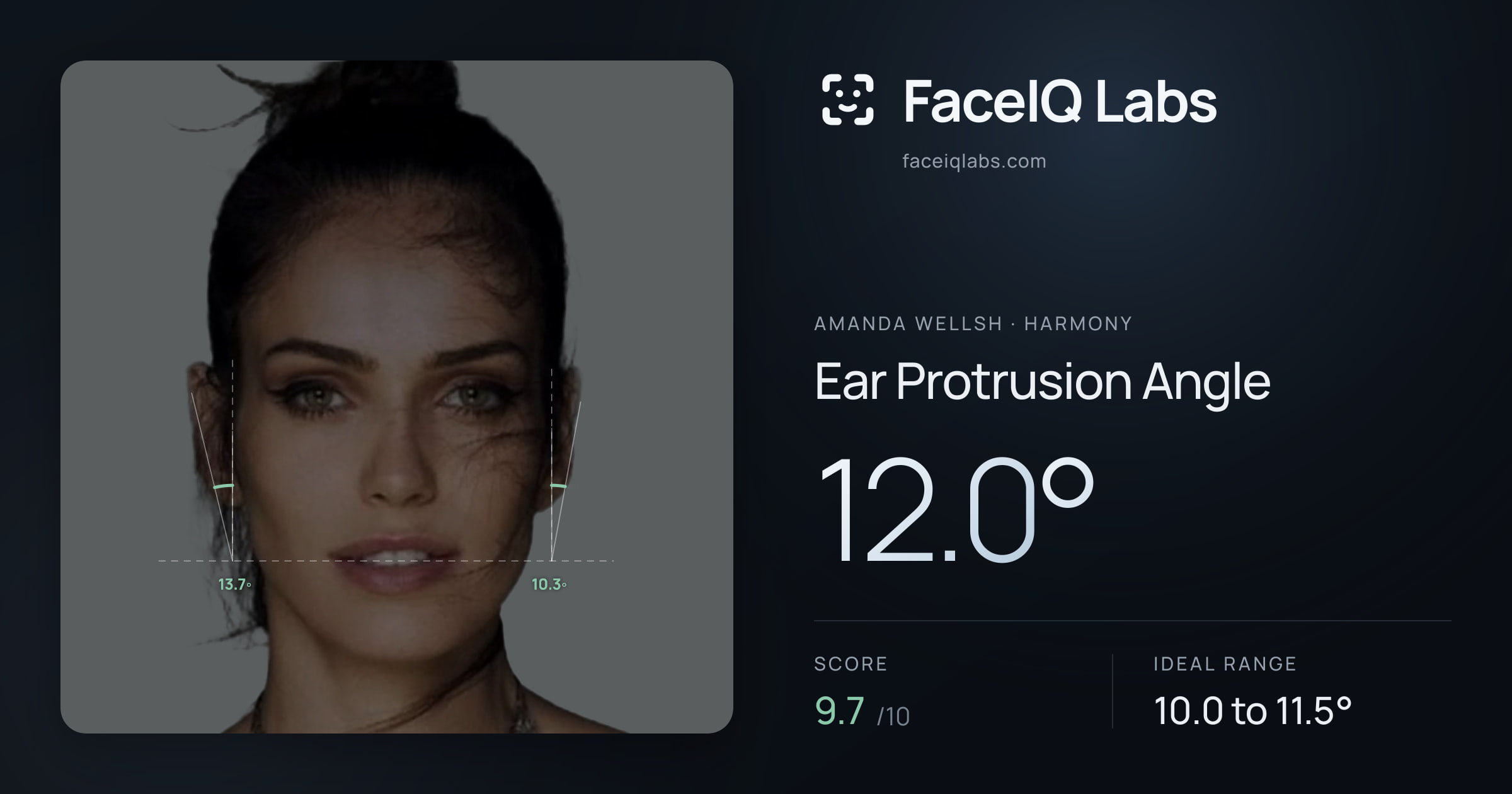 Amanda Wellsh Ear Protrusion Angle: 12.0°, drawn on the photo